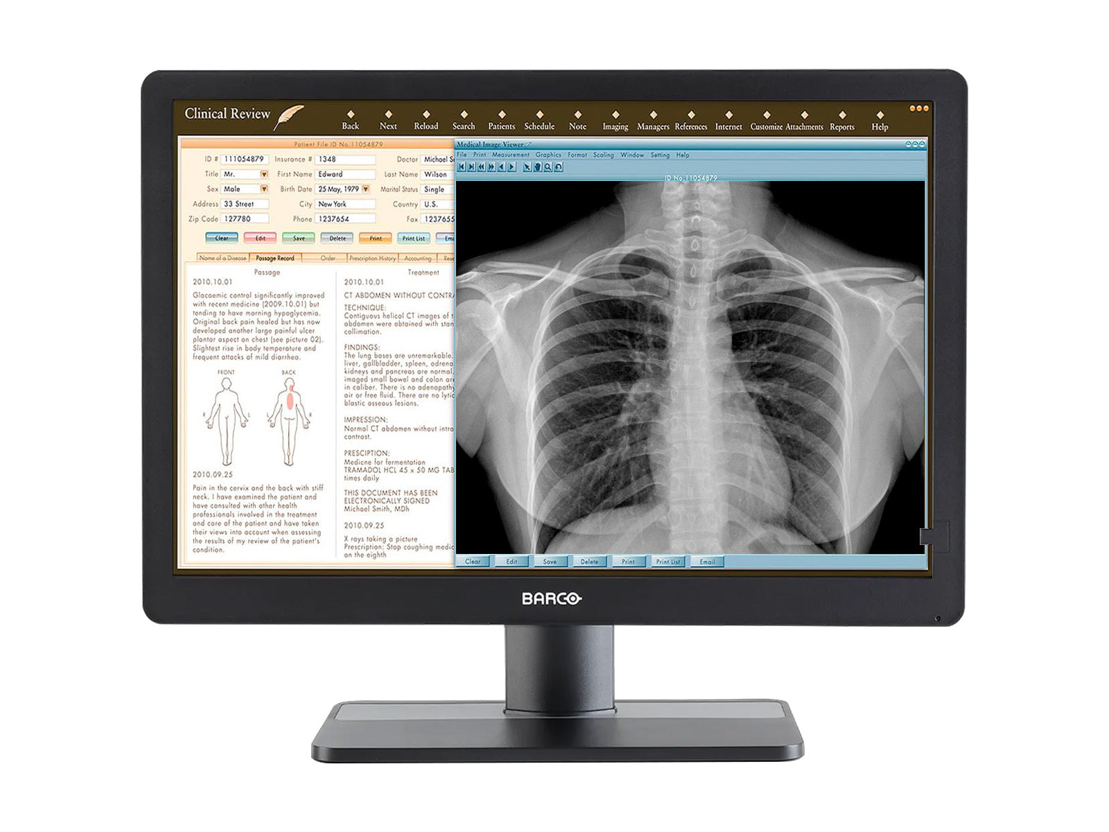 Monitor Médico Barco MDRC-2424 2MP – 24" – Color – Revisión Clínica DICOM (1)