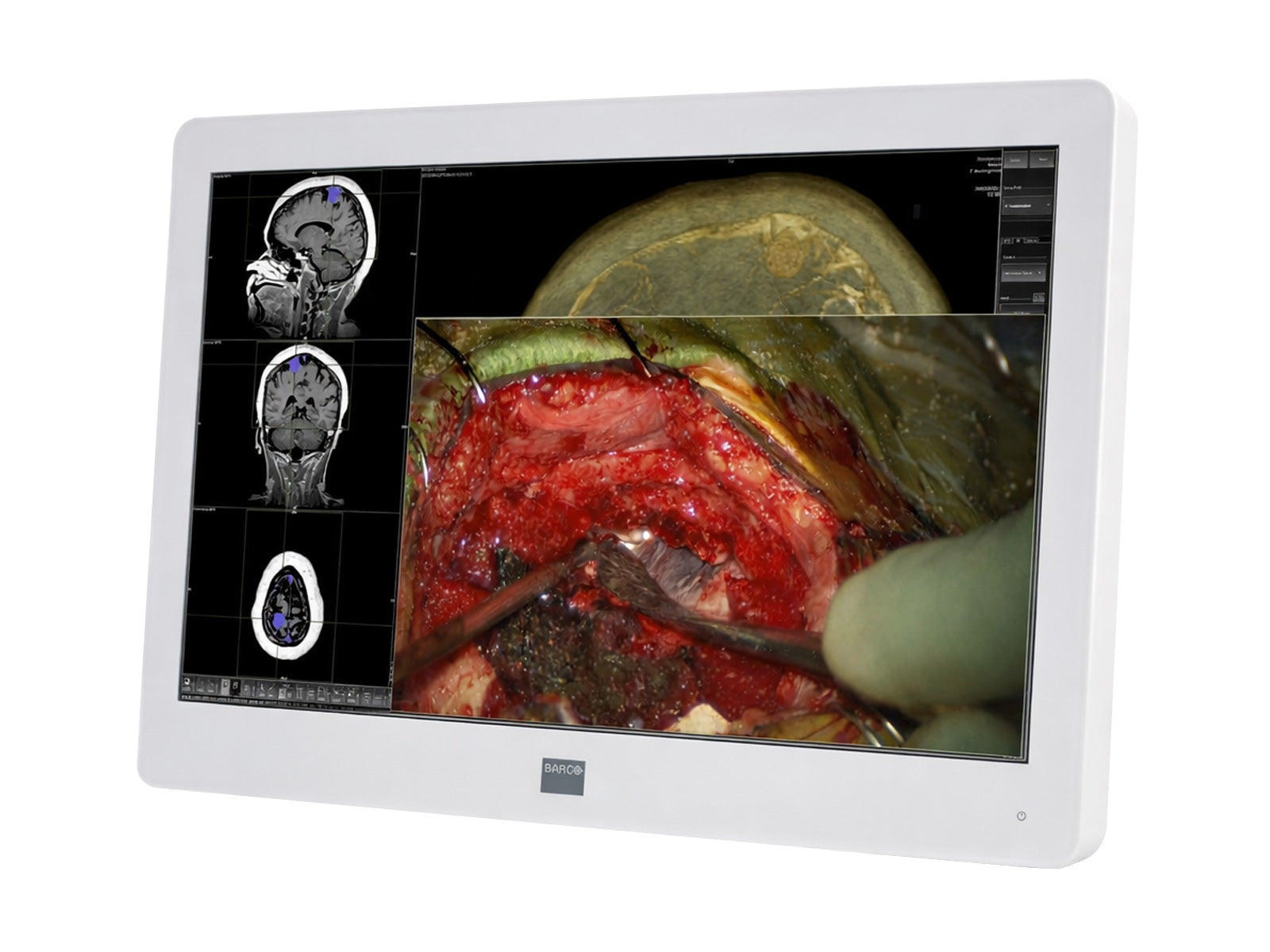 Monitor Médico Barco MDSC-2224 2MP – Uso Quirúrgico (2)