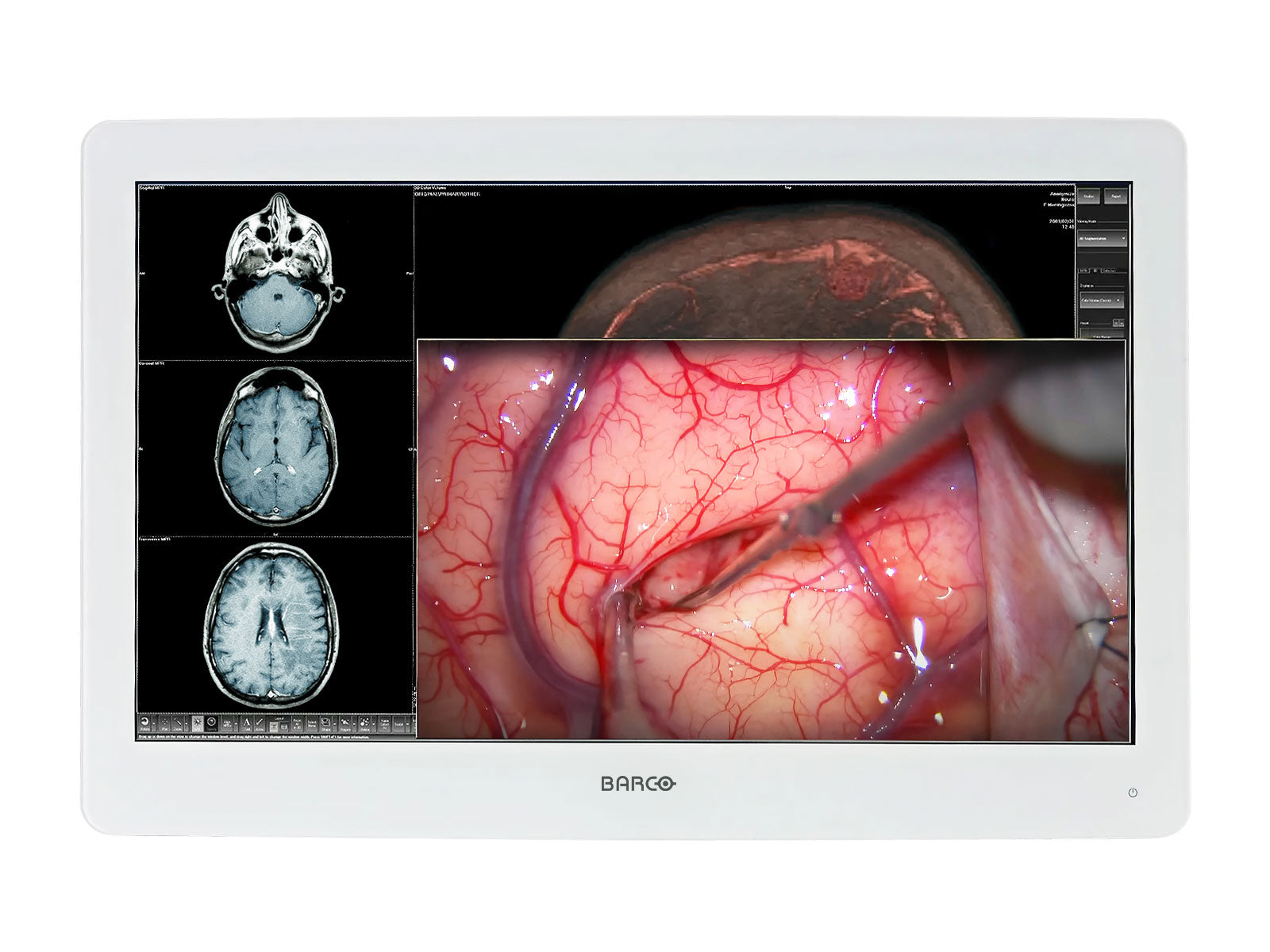 Monitor Médico Barco MDSC-2324 24" – Uso Quirúrgico (1)