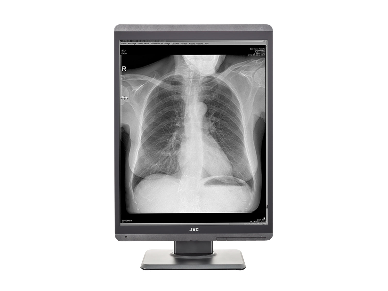 Monitor Médico JVC MS-S200 2MP – 21.3" – Escala de grises – Radiología Diagnóstica DICOM (4)
