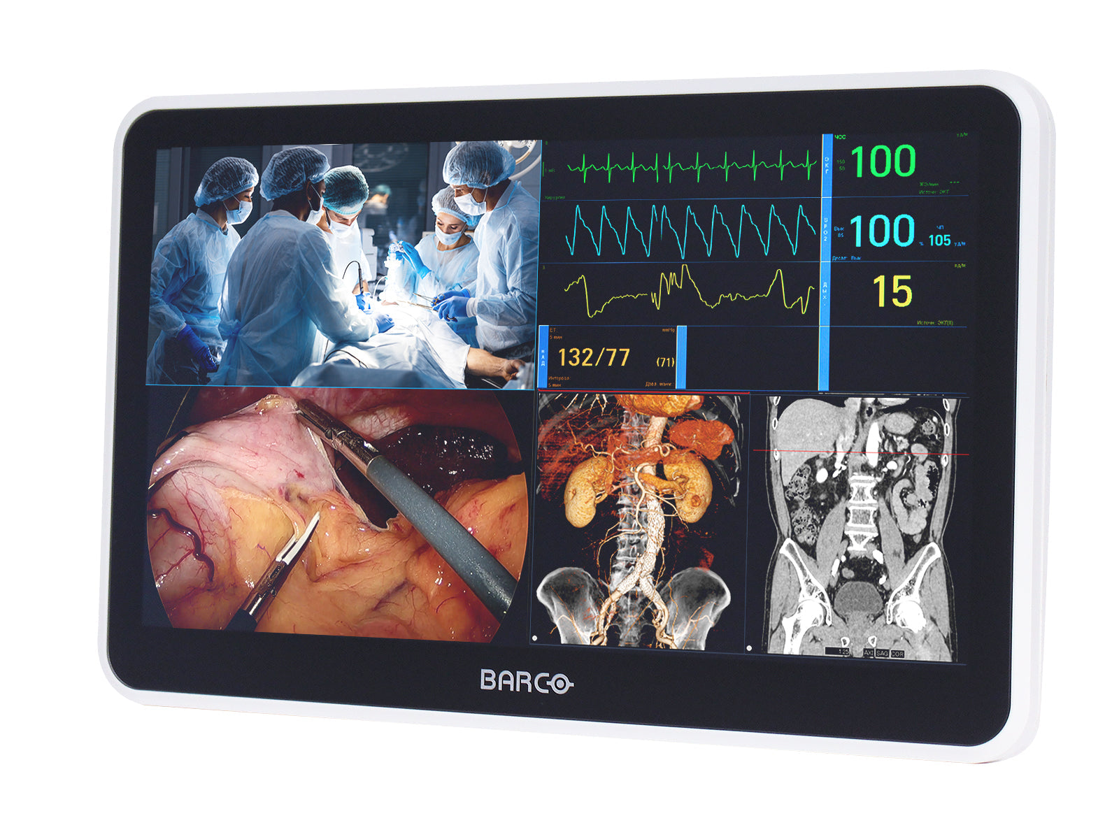 Monitor Médico Barco MUIP-2112 12.5" – Color – Revisión Clínica (3)