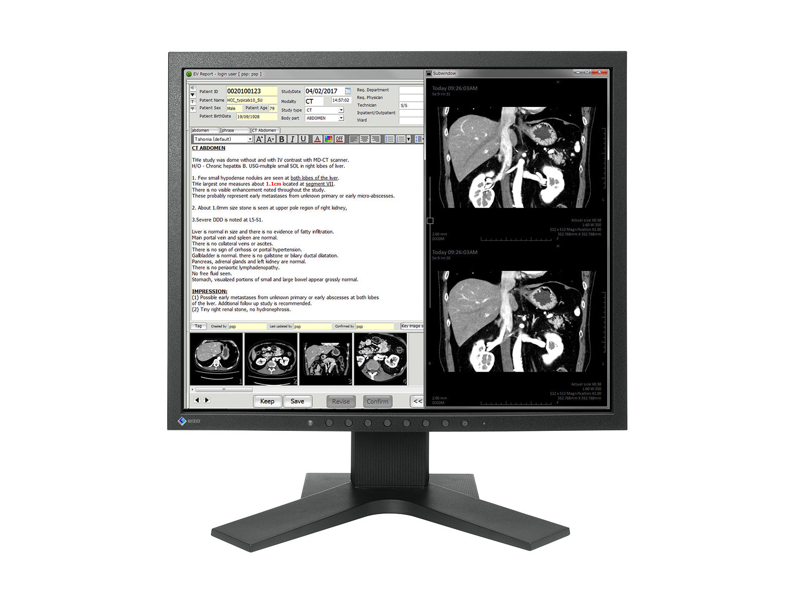Monitor Médico Eizo MX194 1MP – 19" – Revisión Clínica DICOM (1)