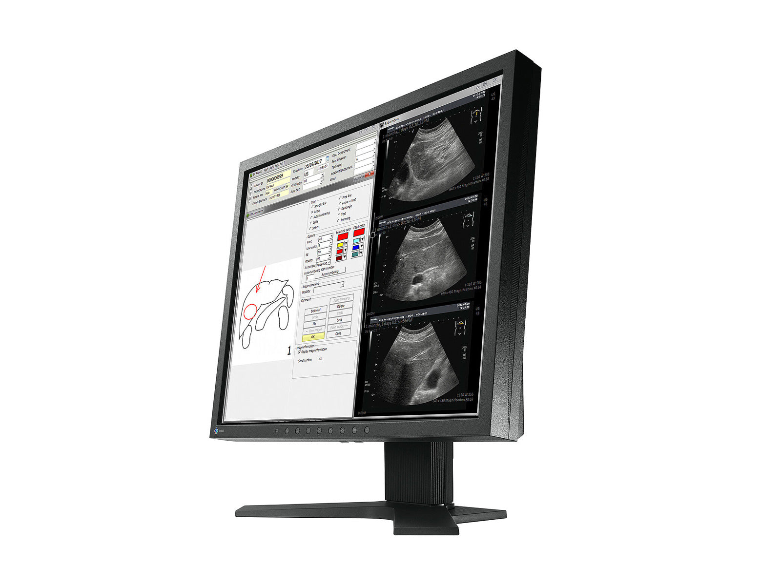 Monitor Médico Eizo MX194 1MP – 19" – Revisión Clínica DICOM (3)