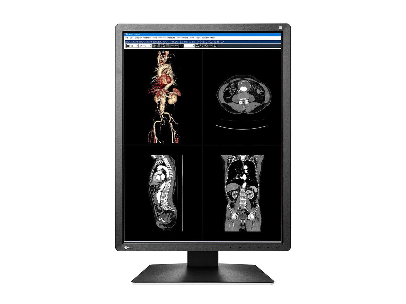 Monitor Médico Eizo MX216-BK 2MP – 21" – Color – Radiología Diagnóstica DICOM (3)