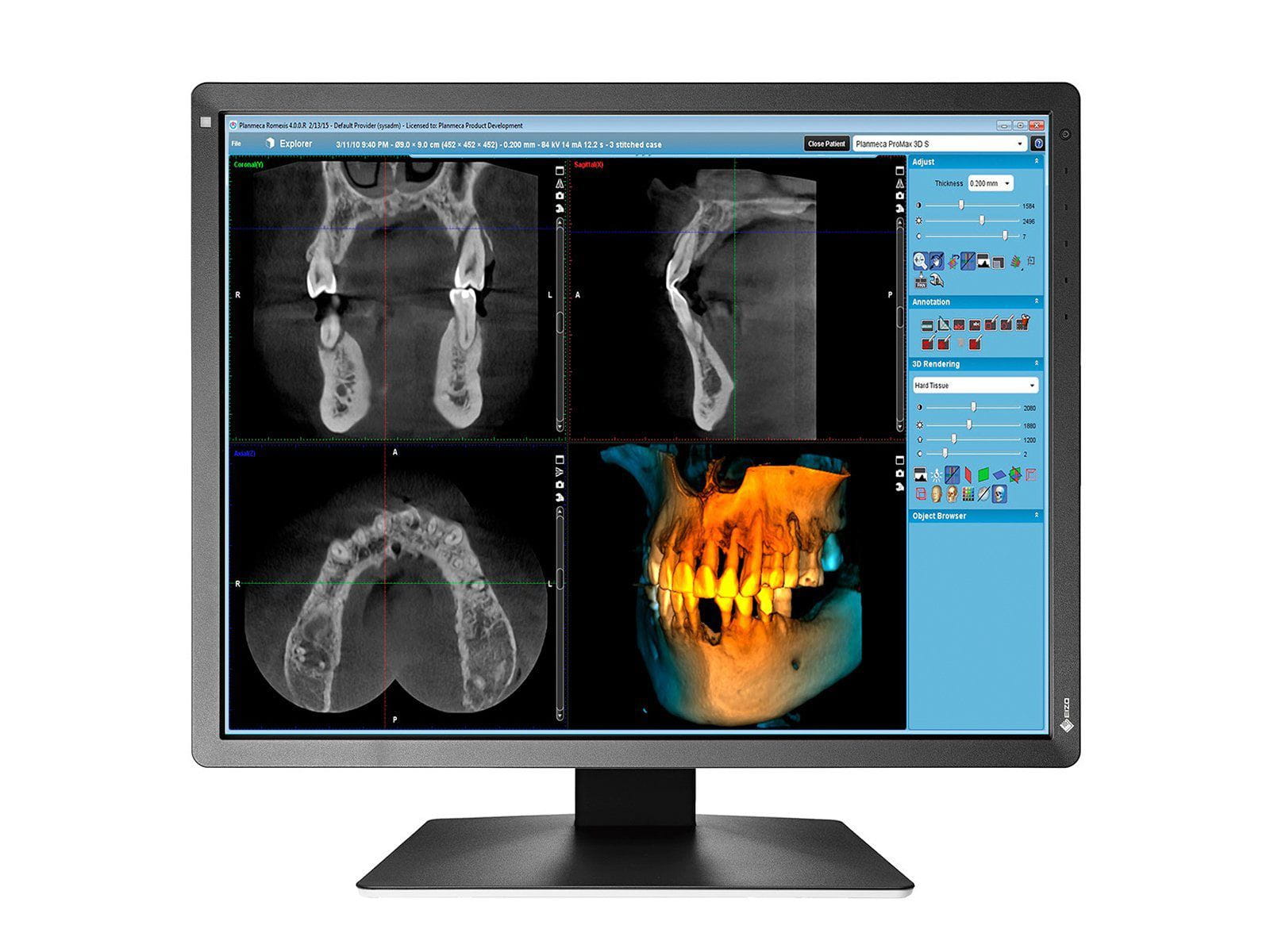 Monitor Médico Eizo MX216-BK 2MP – 21" – Color – Radiología Diagnóstica DICOM (5)