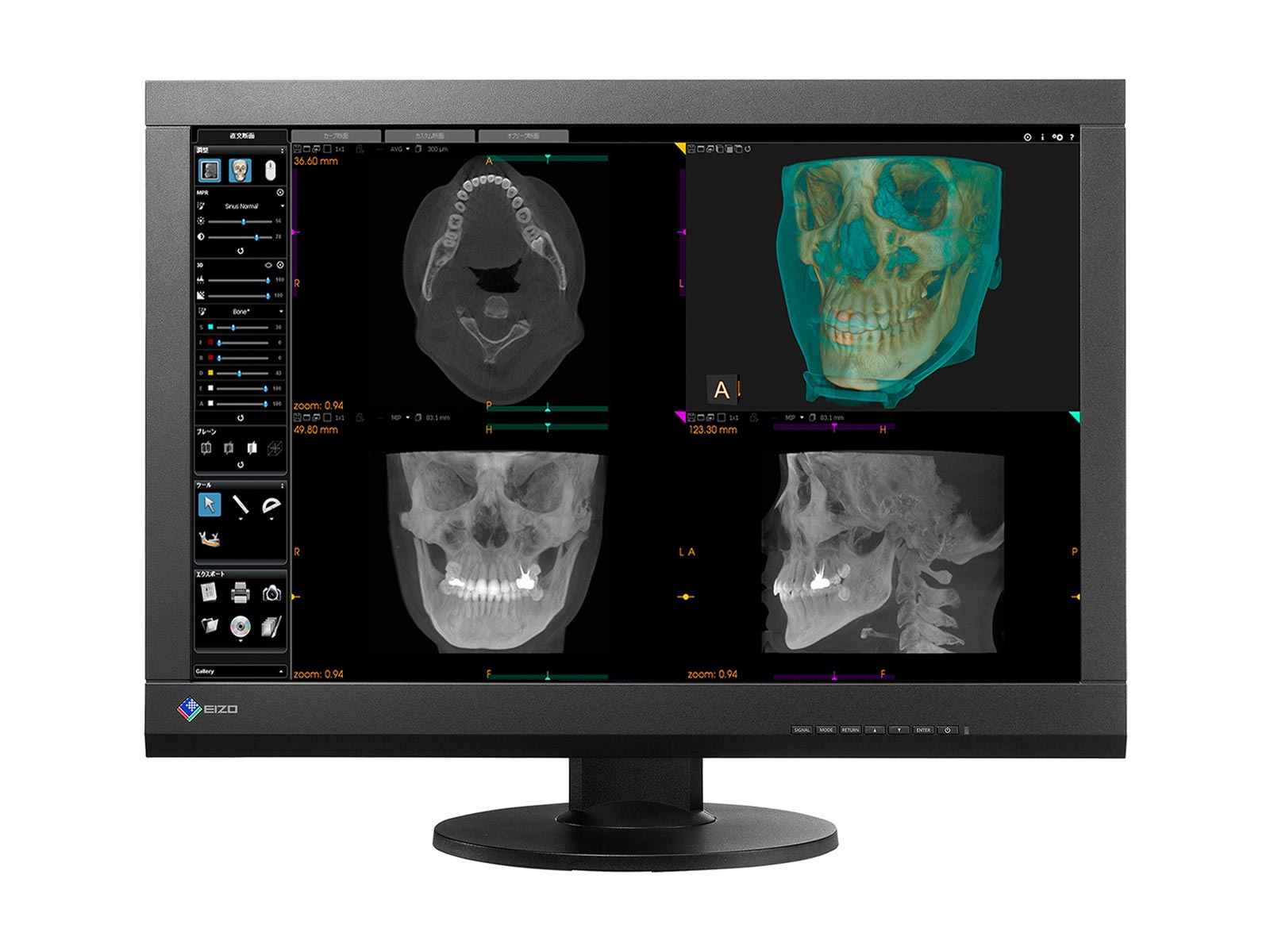 Monitor Médico Eizo MX242W-BK 2.3MP – 24" – Color – Revisión Clínica DICOM (1)