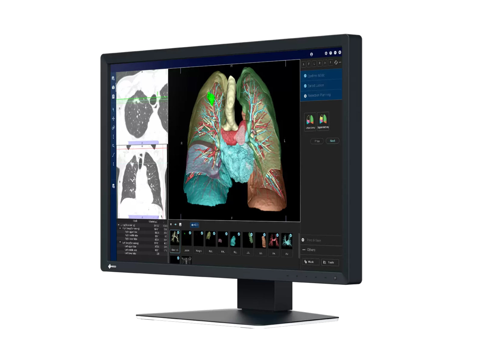 Monitor Médico Eizo MX243W 2.3MP – 24" – Color – Revisión Clínica DICOM (2)
