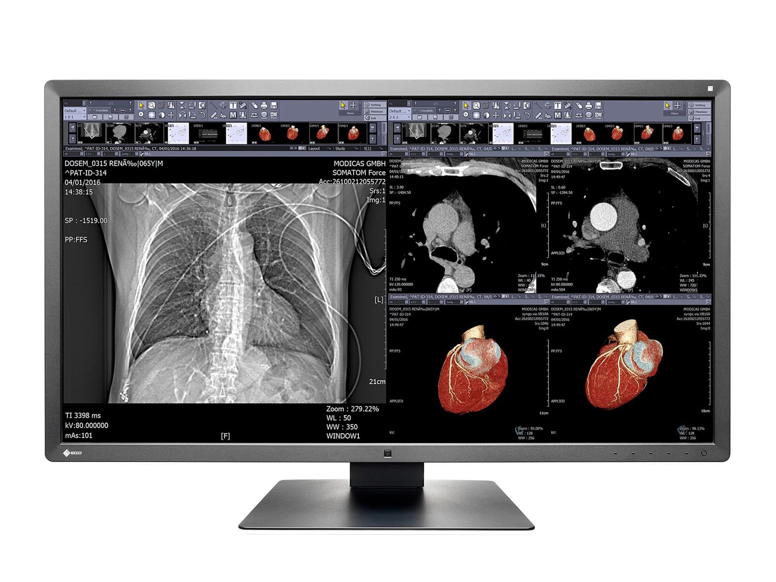Monitor Médico Eizo MX315W-BK 8MP – 31.1" – Color – Radiología Diagnóstica DICOM (1)