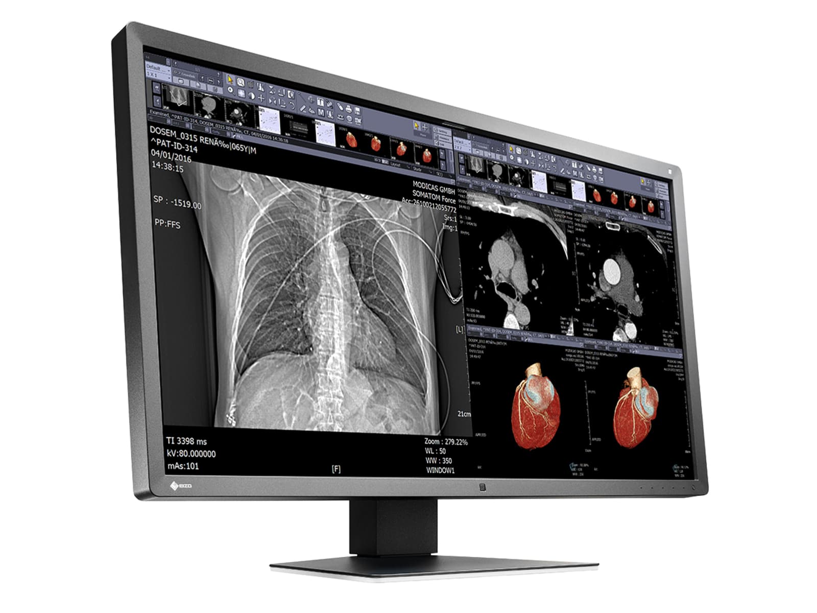 Monitor Médico Eizo MX315W-BK 8MP – 31.1" – Color – Radiología Diagnóstica DICOM (2)