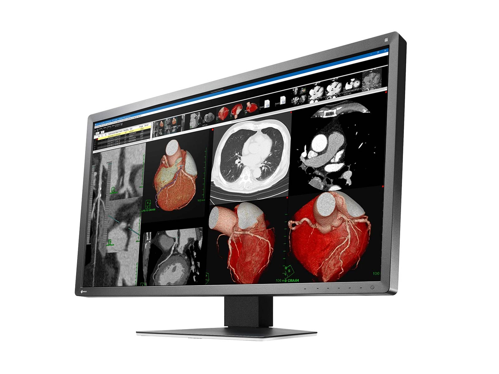 Monitor Médico Eizo MX317W-BK 8MP – 30.5" – Color – Radiología Diagnóstica DICOM (3)