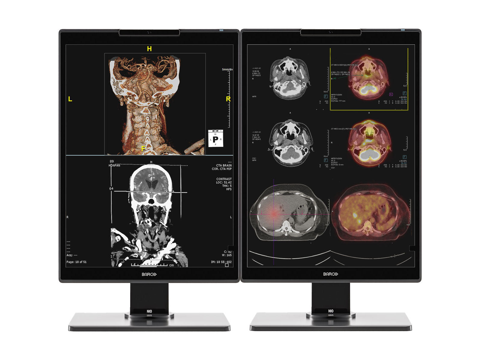 Monitor Médico Barco MDNC-3521 3MP – 21.3" – Color – Radiología Diagnóstica DICOM (1)