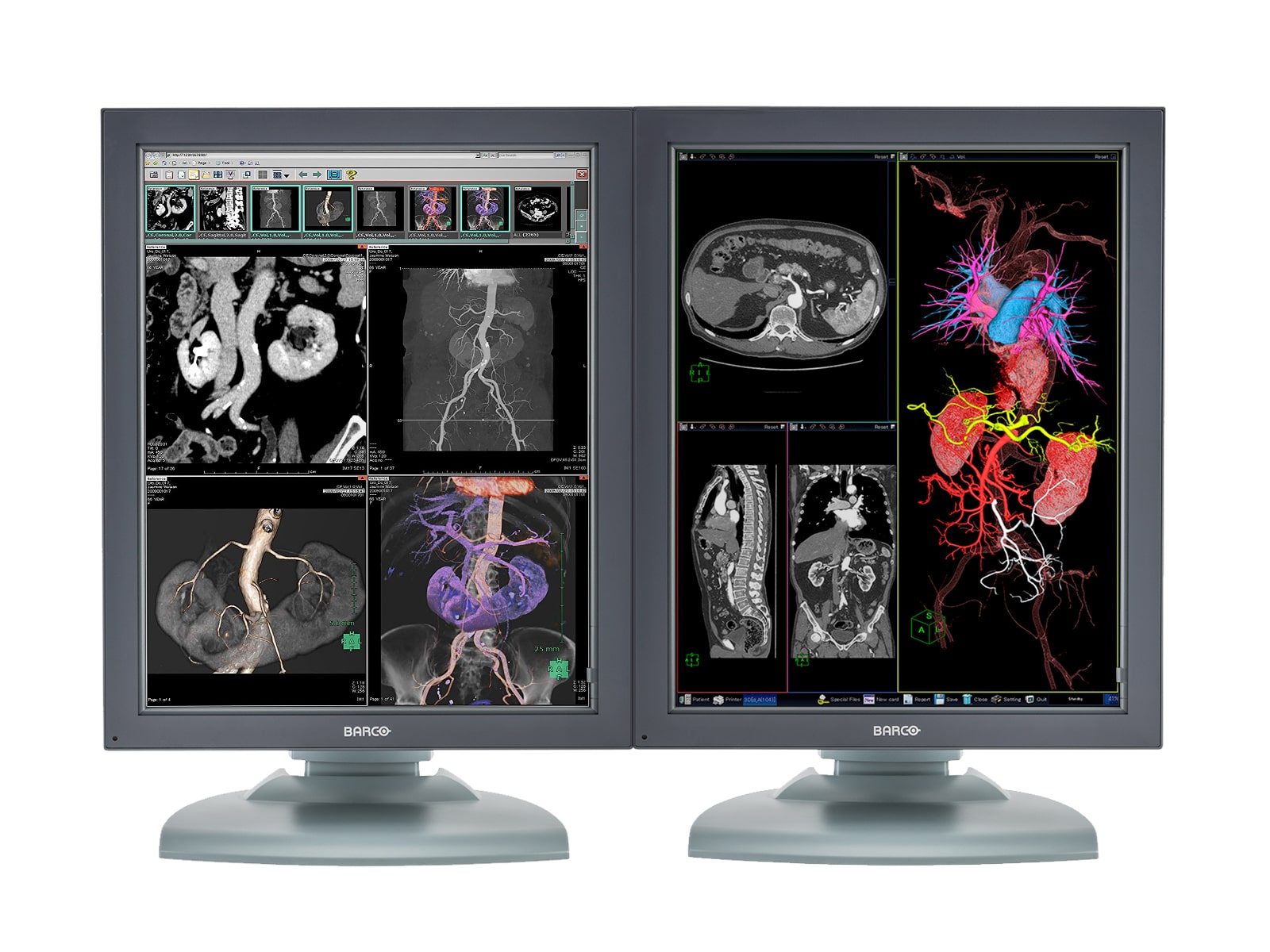 Monitor Médico Barco MDNC-3121 3MP – 21" – Color – Radiología Diagnóstica DICOM (1)