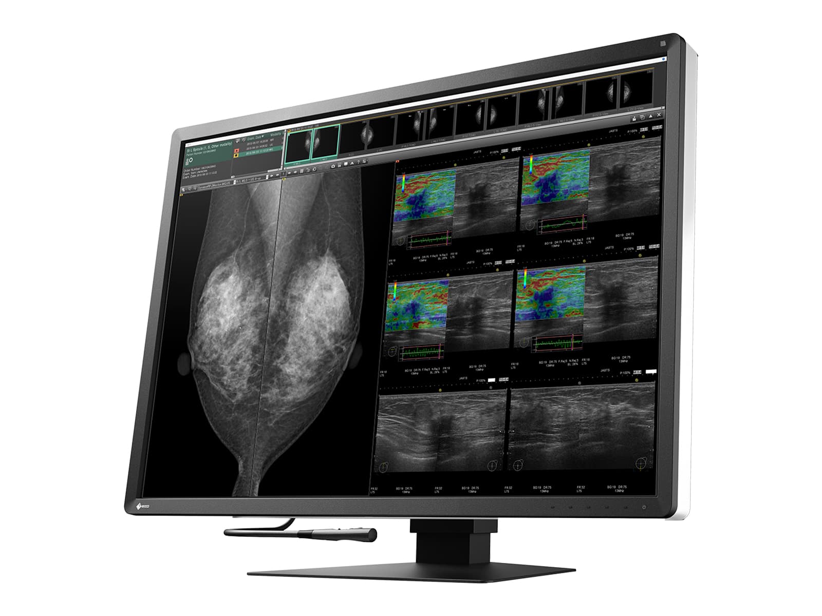 Monitor Médico Eizo RX1270 12MP – 31" – Color – Radiología Diagnóstica DICOM (2)