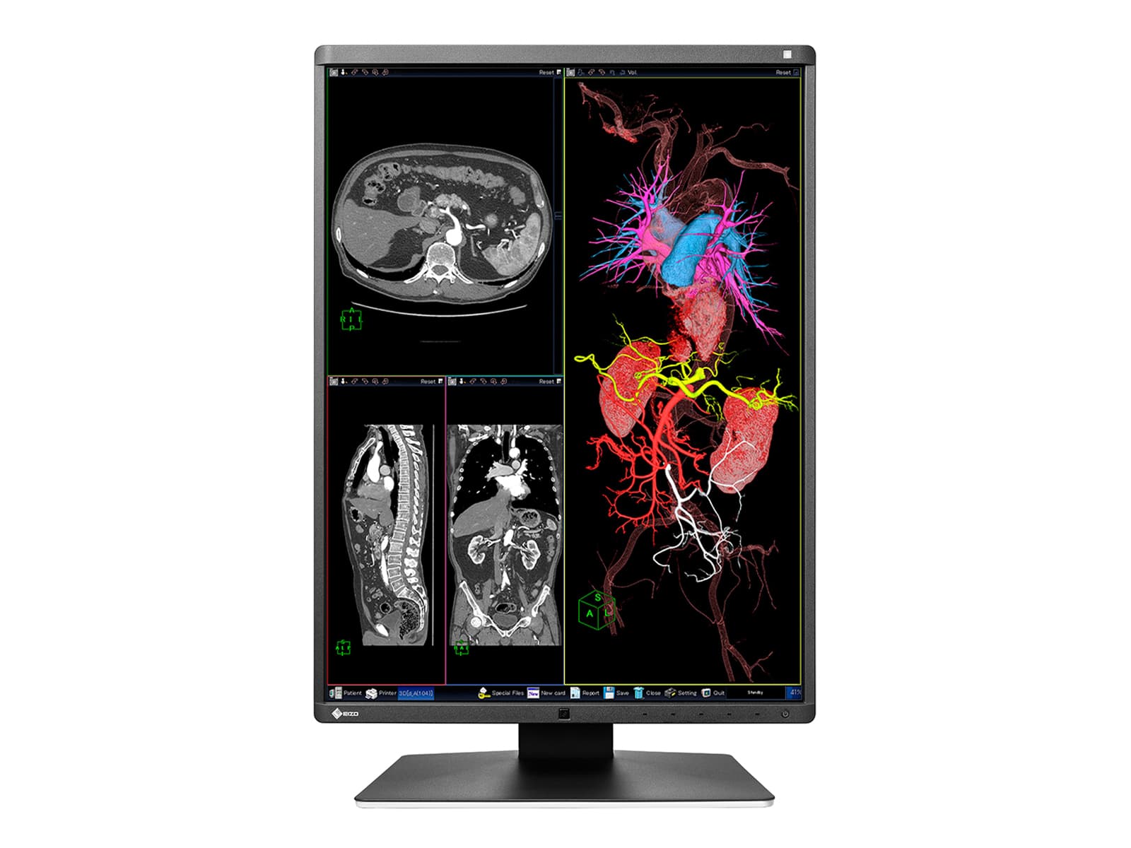 Monitor Médico Eizo RX350 3MP – 21" – Color – Radiología Diagnóstica DICOM (4)