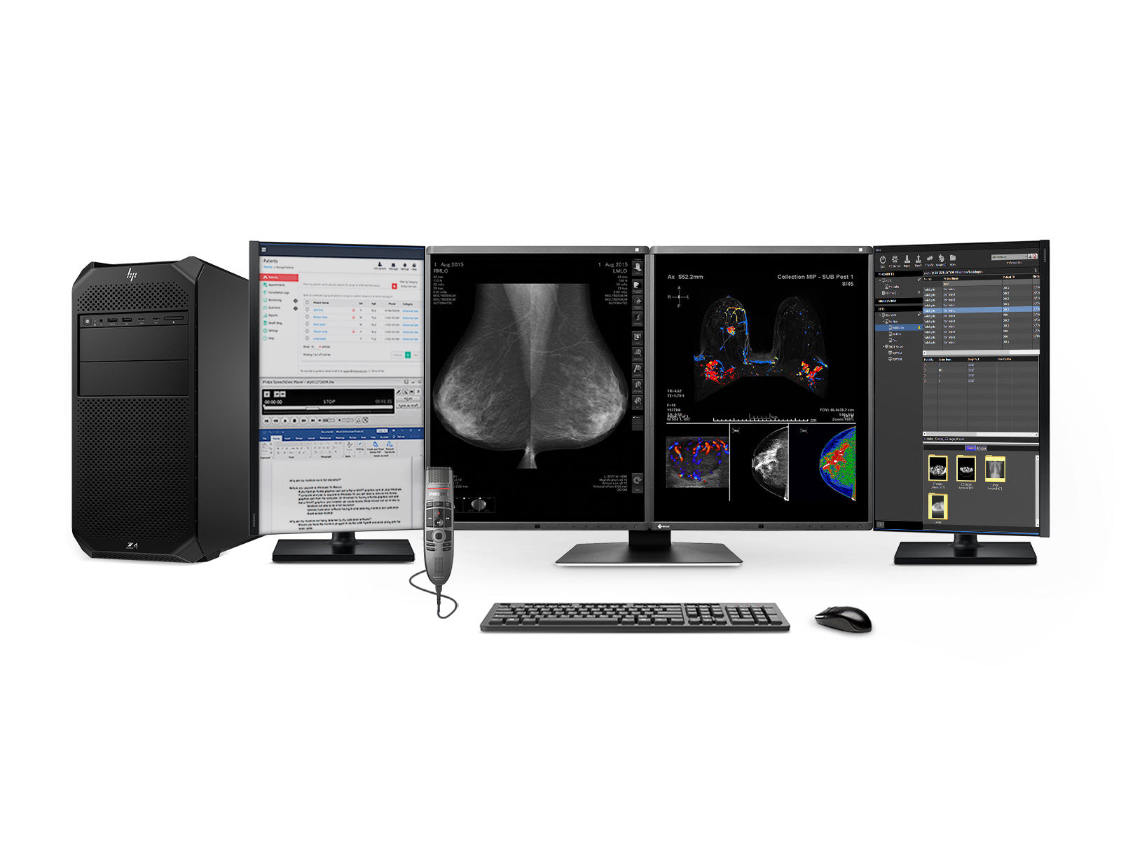 Estación de Lectura de Mamografía PACS Eizo RX560Z4G5 – 5MP – Color – Sistema Completo (1)