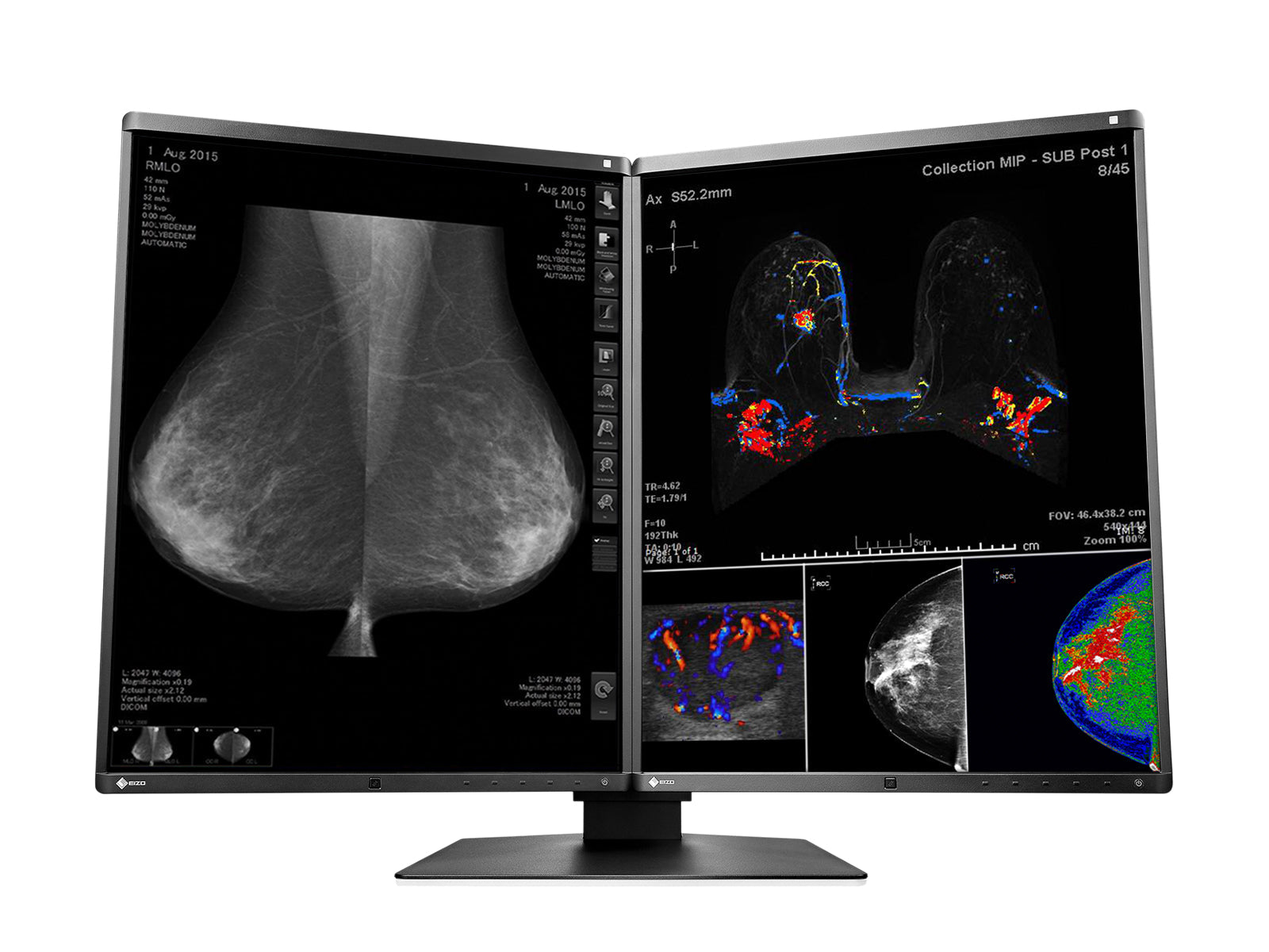 Monitor Médico Eizo RX560-BK 5MP – 21" – Color – Radiología Diagnóstica DICOM (4)