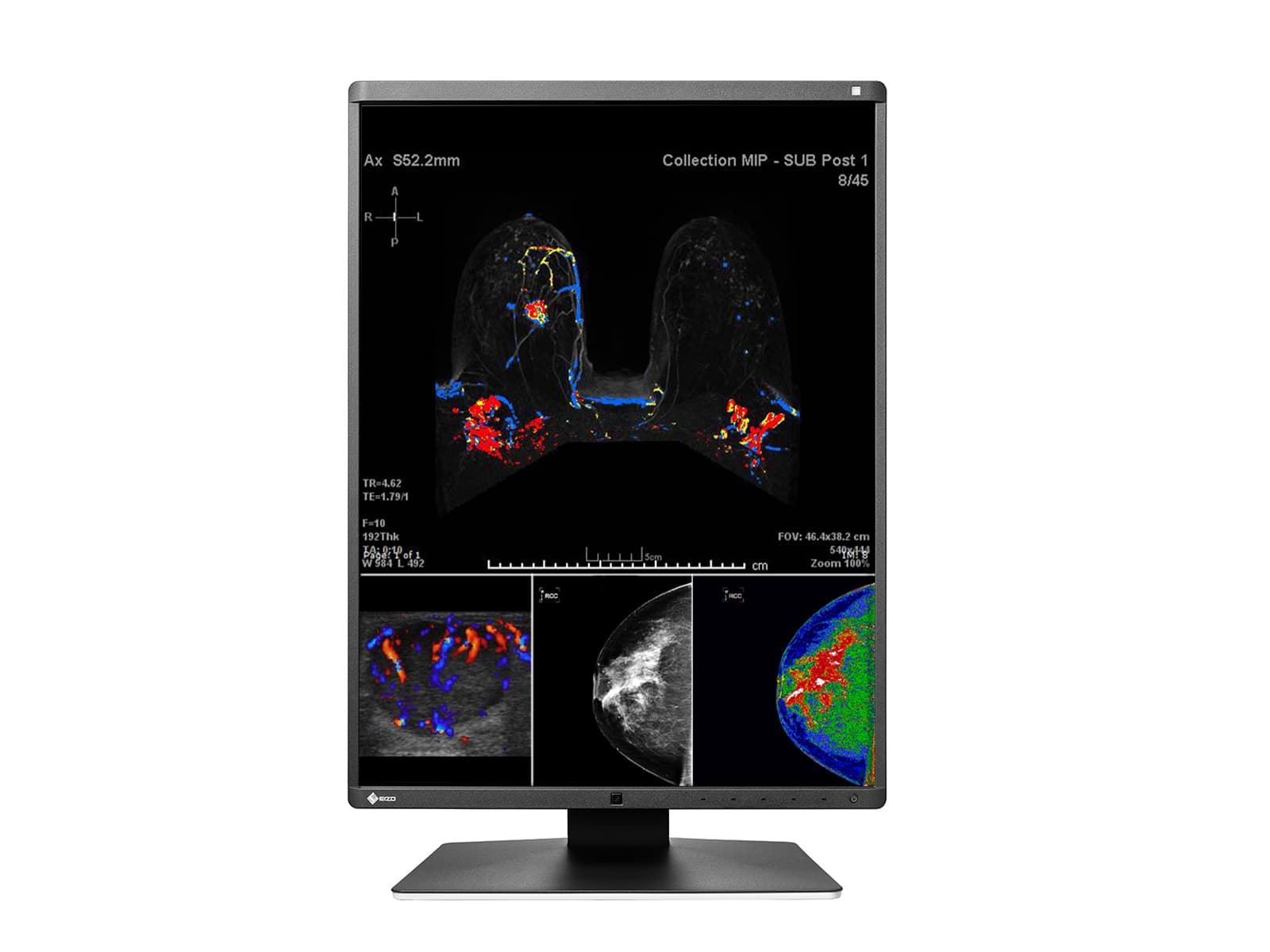Monitor Médico Eizo RX560-BK 5MP – 21" – Color – Radiología Diagnóstica DICOM (3)