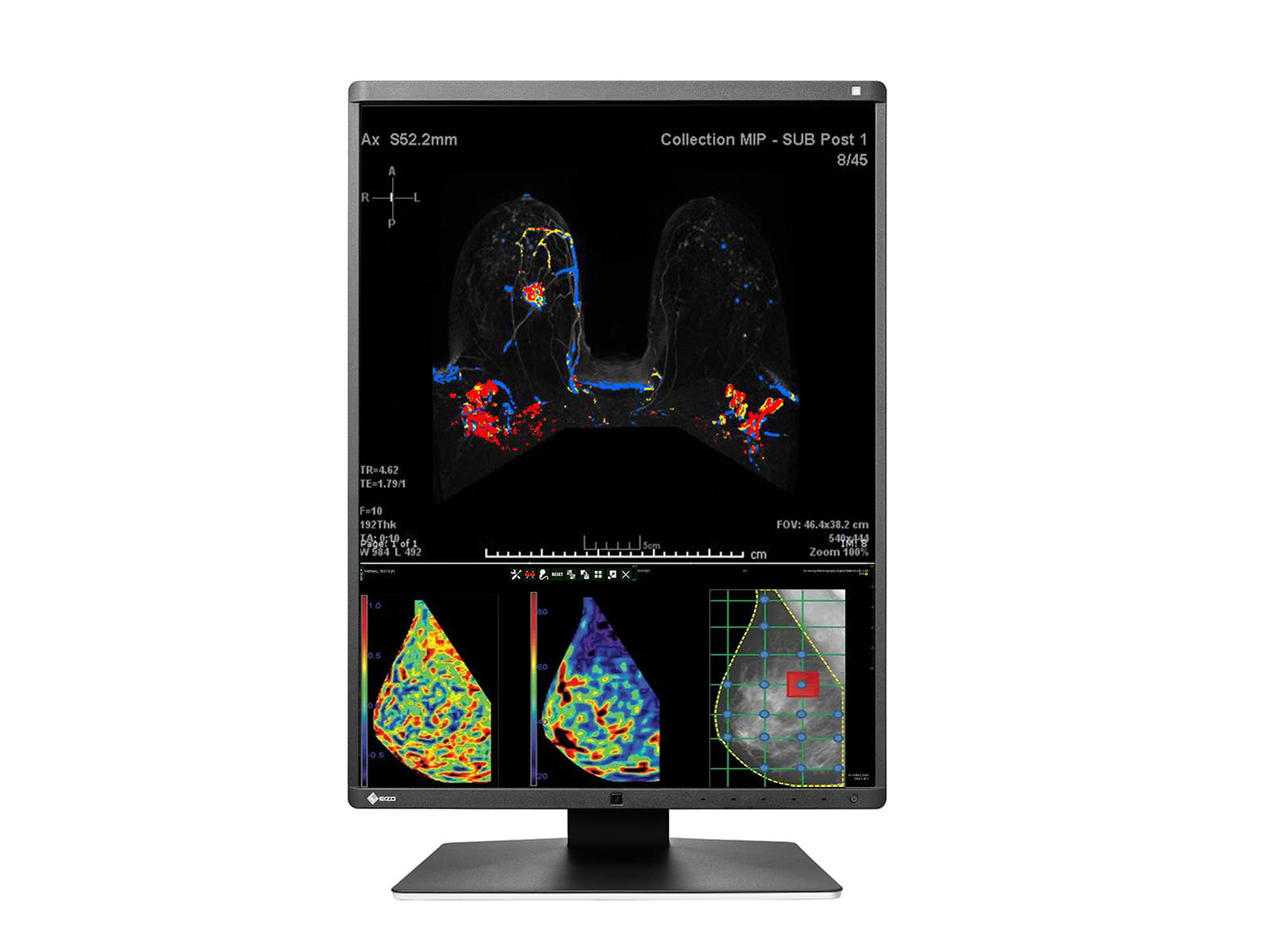 Monitor Médico Eizo RX570-BK 5MP – 21" – Color – Radiología Diagnóstica DICOM (4)