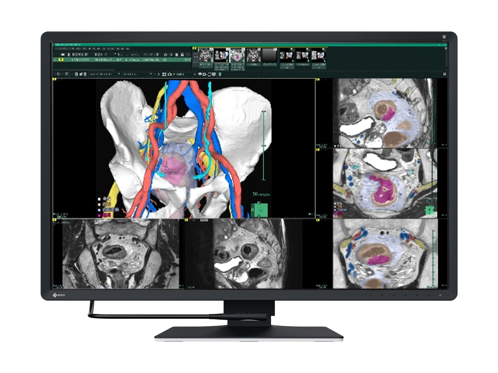 Monitor Médico Eizo RX670 6MP – 30" – Color – Radiología Diagnóstica DICOM (1)