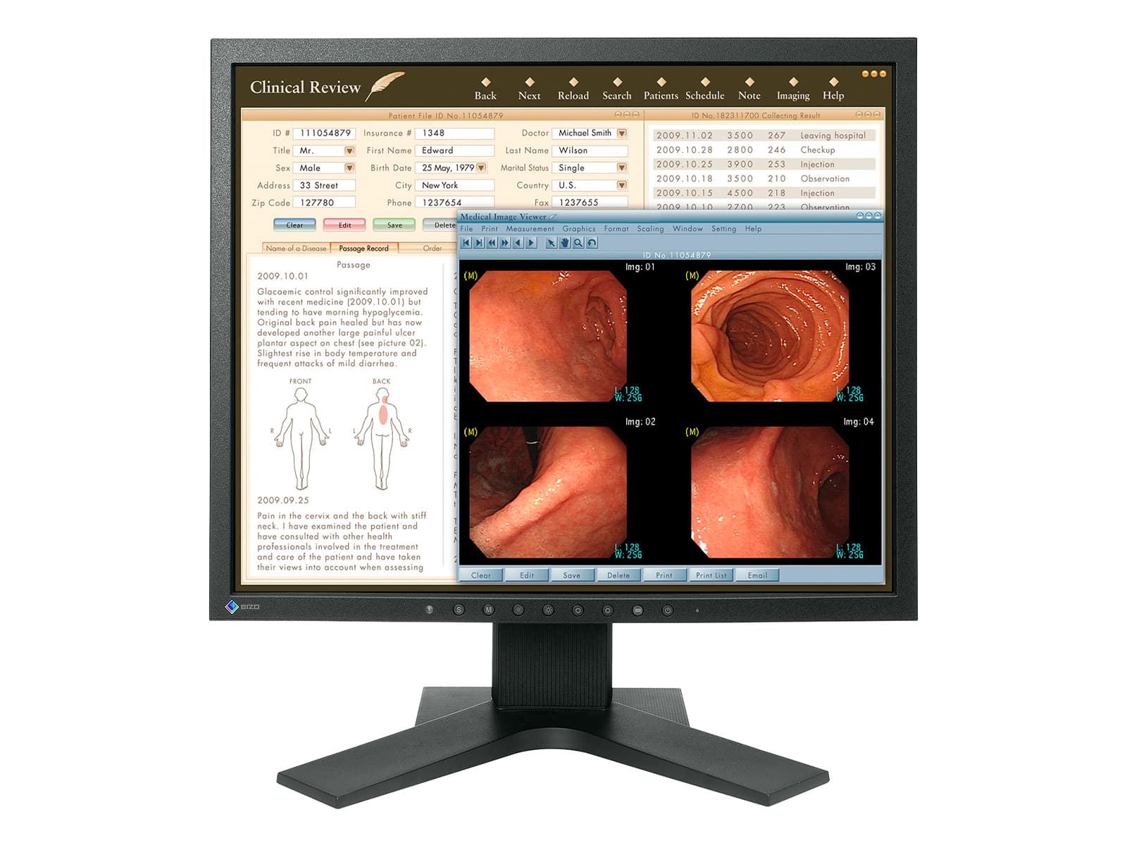 Monitor Médico Eizo MX191 1MP – 19" – Color – Revisión Clínica DICOM (1)