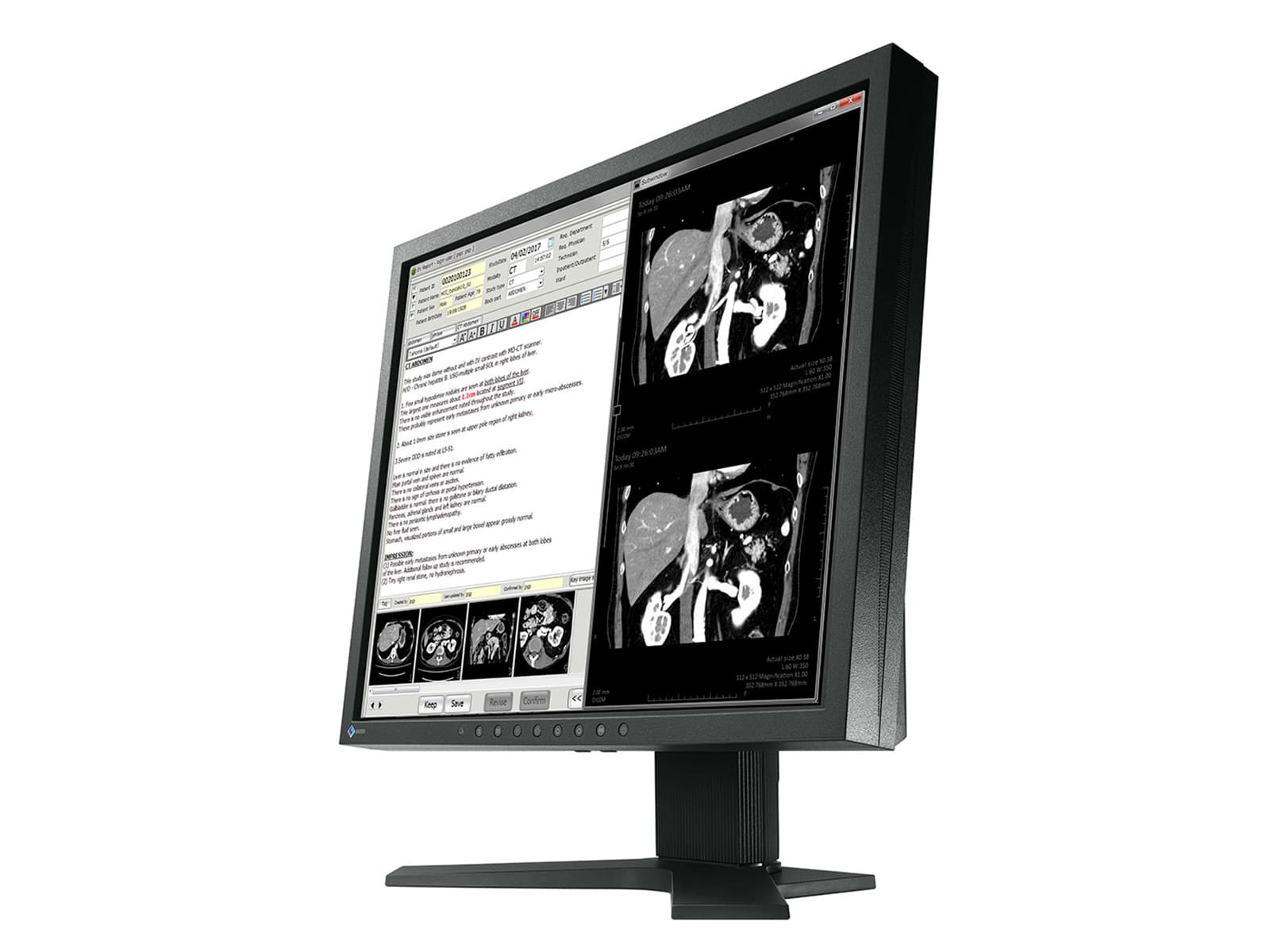 Monitor Médico Eizo MX191 1MP – 19" – Color – Revisión Clínica DICOM (2)