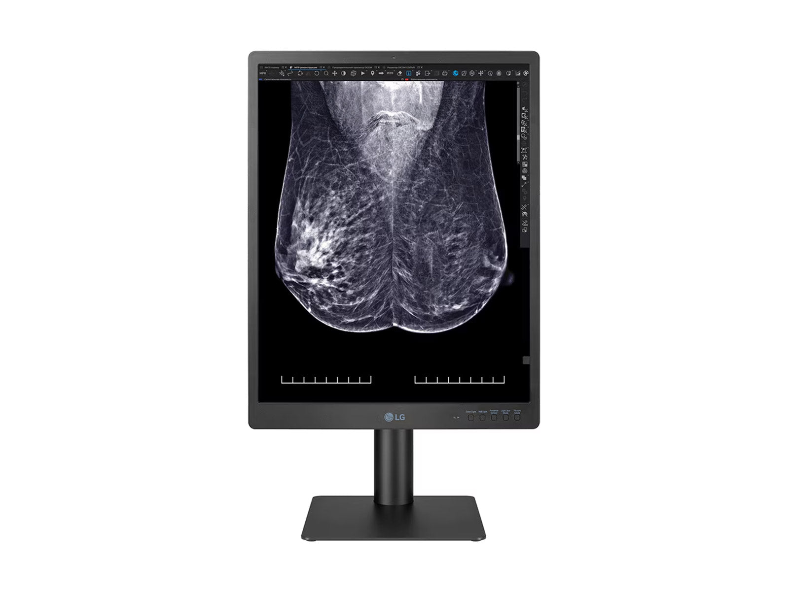 Monitor Médico LG 21HQ613D-B 5MP – 21" – Color – Radiología Diagnóstica DICOM (2)