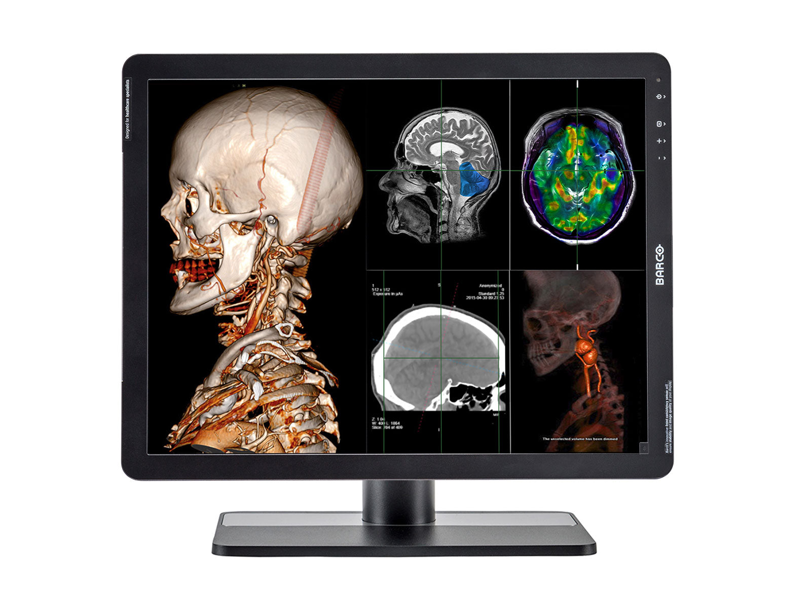 Monitor Médico Barco MDRC-2221 2MP – 21" – Radiología Diagnóstica DICOM (1)