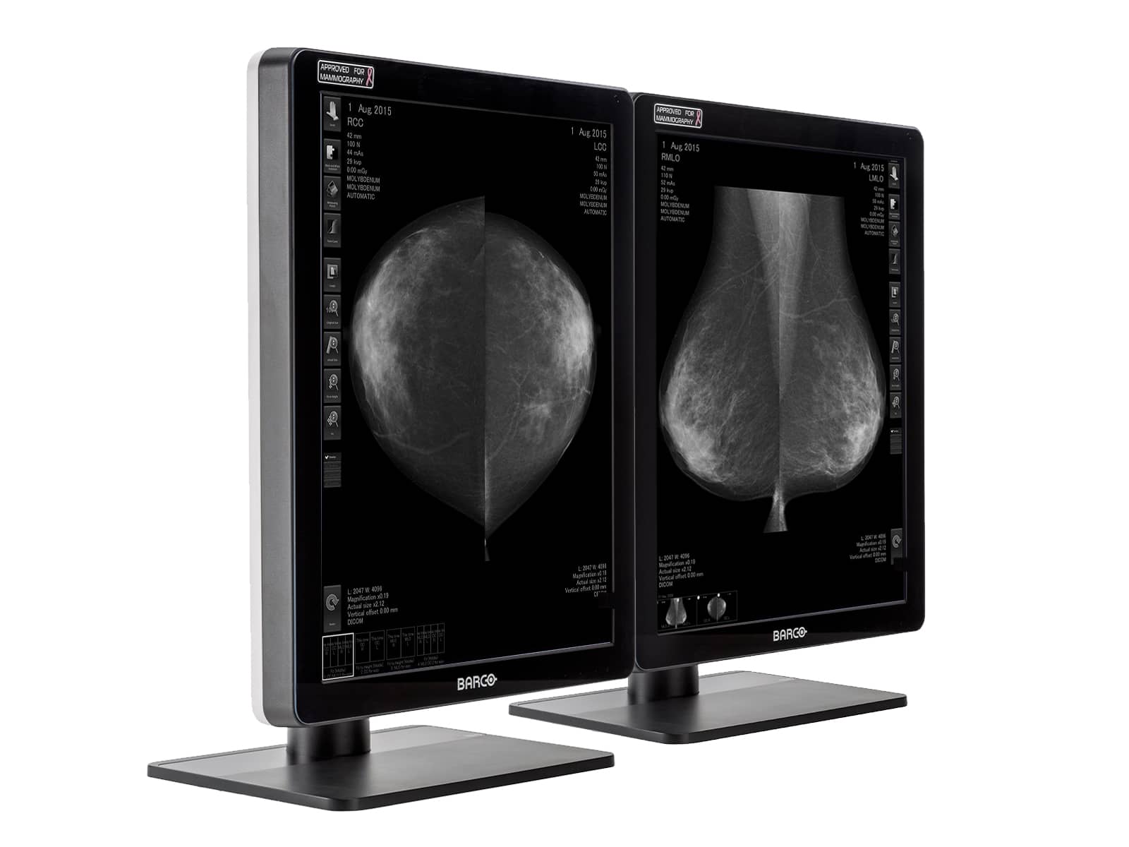 Monitor Médico Barco MDCG-5221 5MP – 21.3" – Escala de grises – Radiología Diagnóstica DICOM (2)