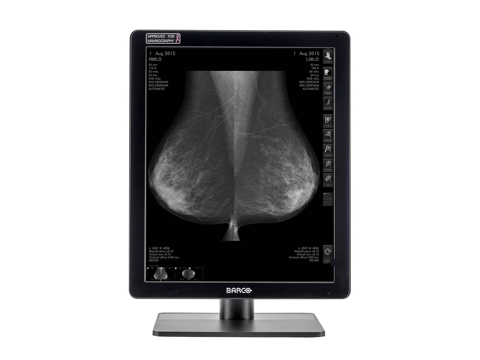 Monitor Médico Barco MDCG-5221 5MP – 21.3" – Escala de grises – Radiología Diagnóstica DICOM (3)