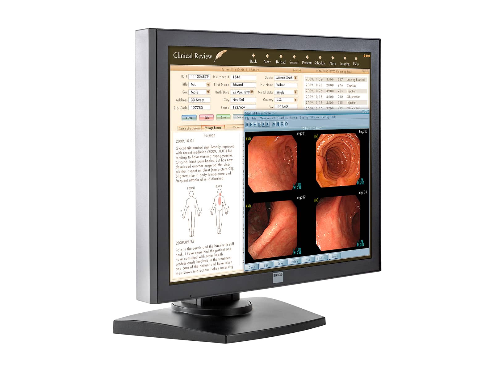 Monitor Médico Barco MDRC-2120 2MP – 20" – Color – Revisión Clínica DICOM (2)