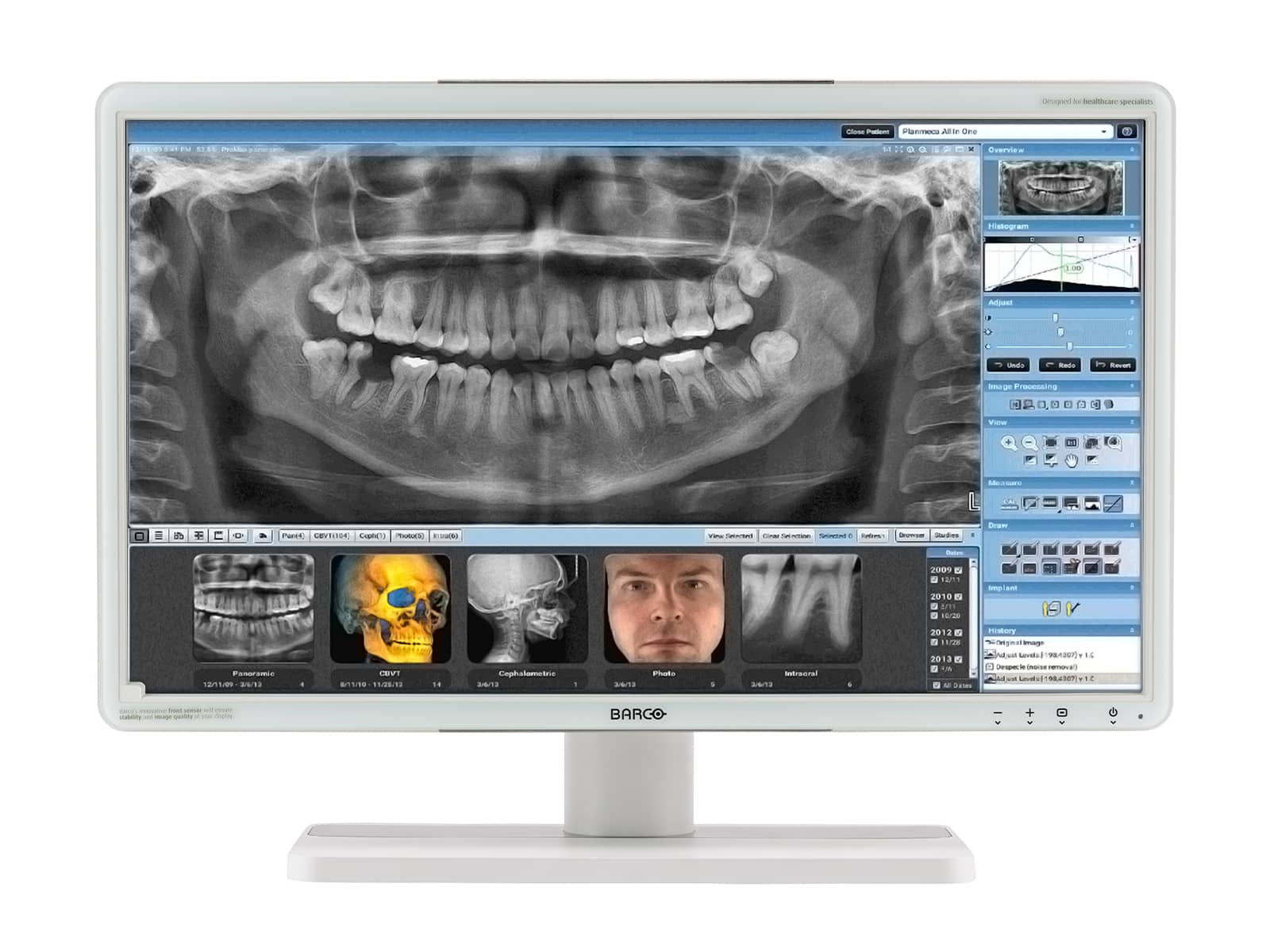 Monitor Médico Barco MDRC-2224 2MP – 24" – Color – Revisión Clínica DICOM (1)