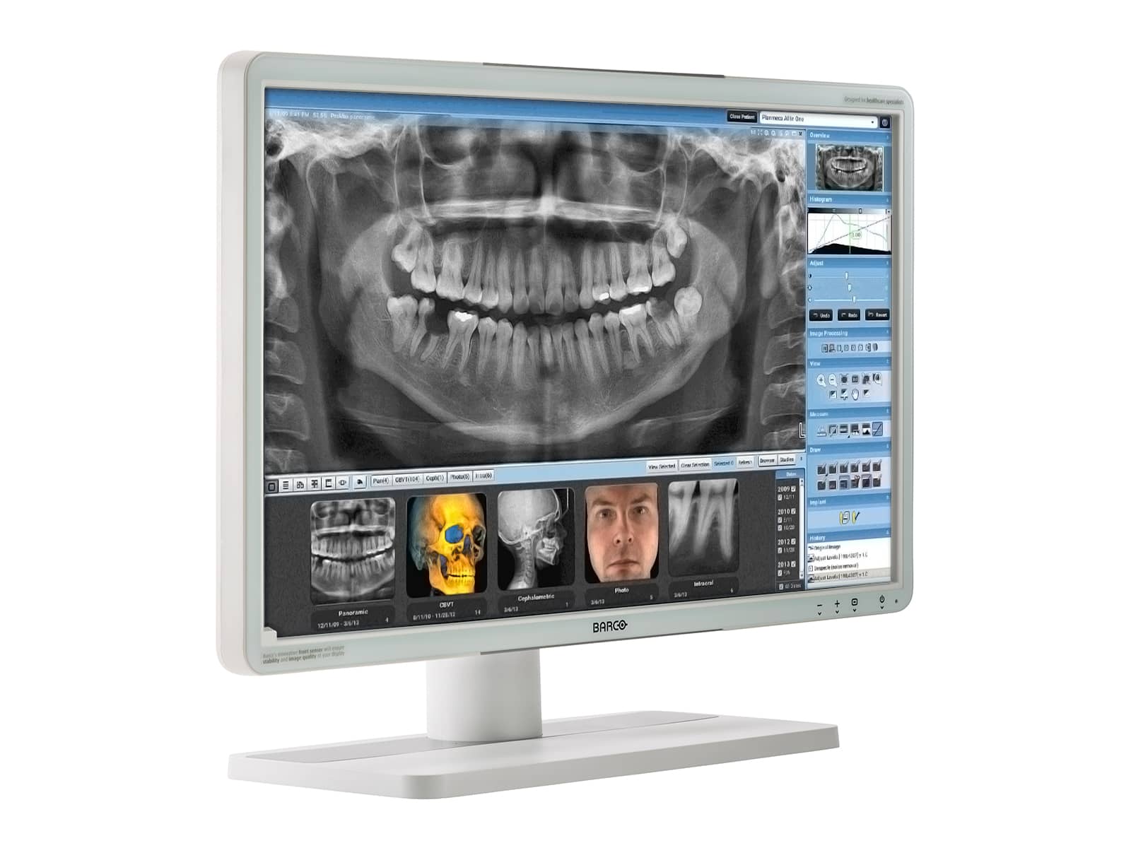 Monitor Médico Barco MDRC-2224 2MP – 24" – Color – Revisión Clínica DICOM (2)