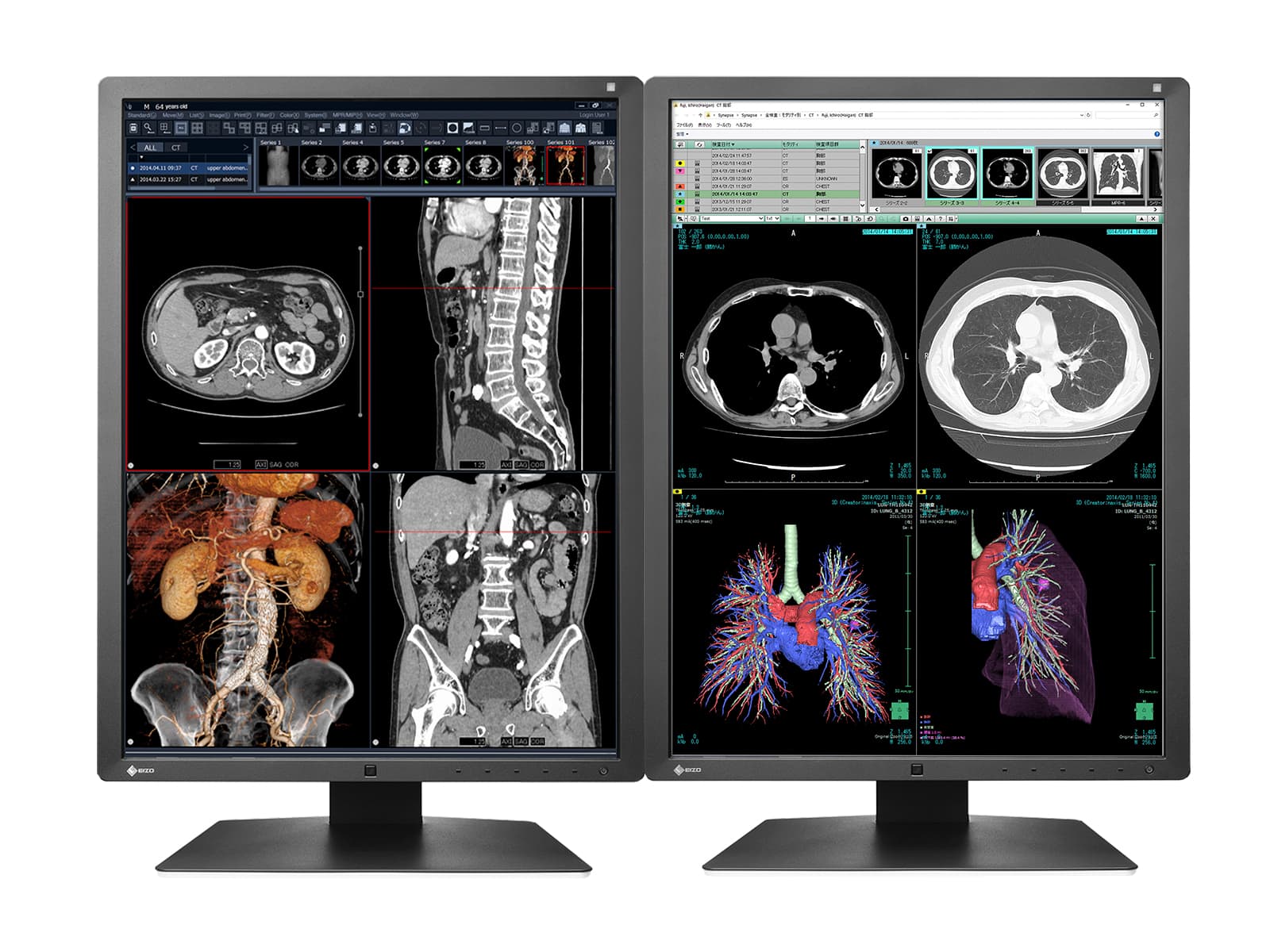 Monitor Médico Eizo RX250-BK 2MP – 21" – Color – Radiología Diagnóstica DICOM (1)