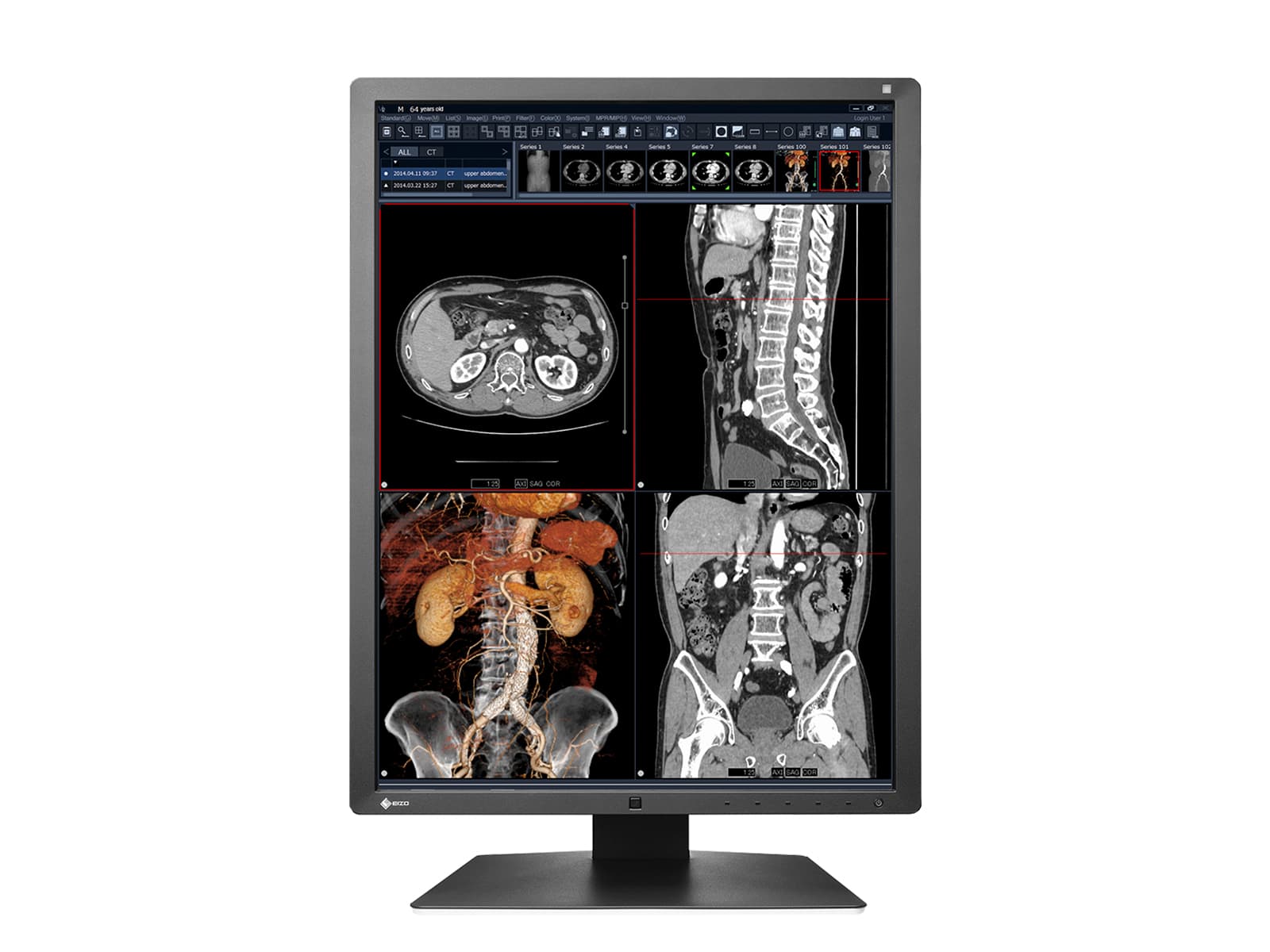 Monitor Médico Eizo RX250-BK 2MP – 21" – Color – Radiología Diagnóstica DICOM (4)