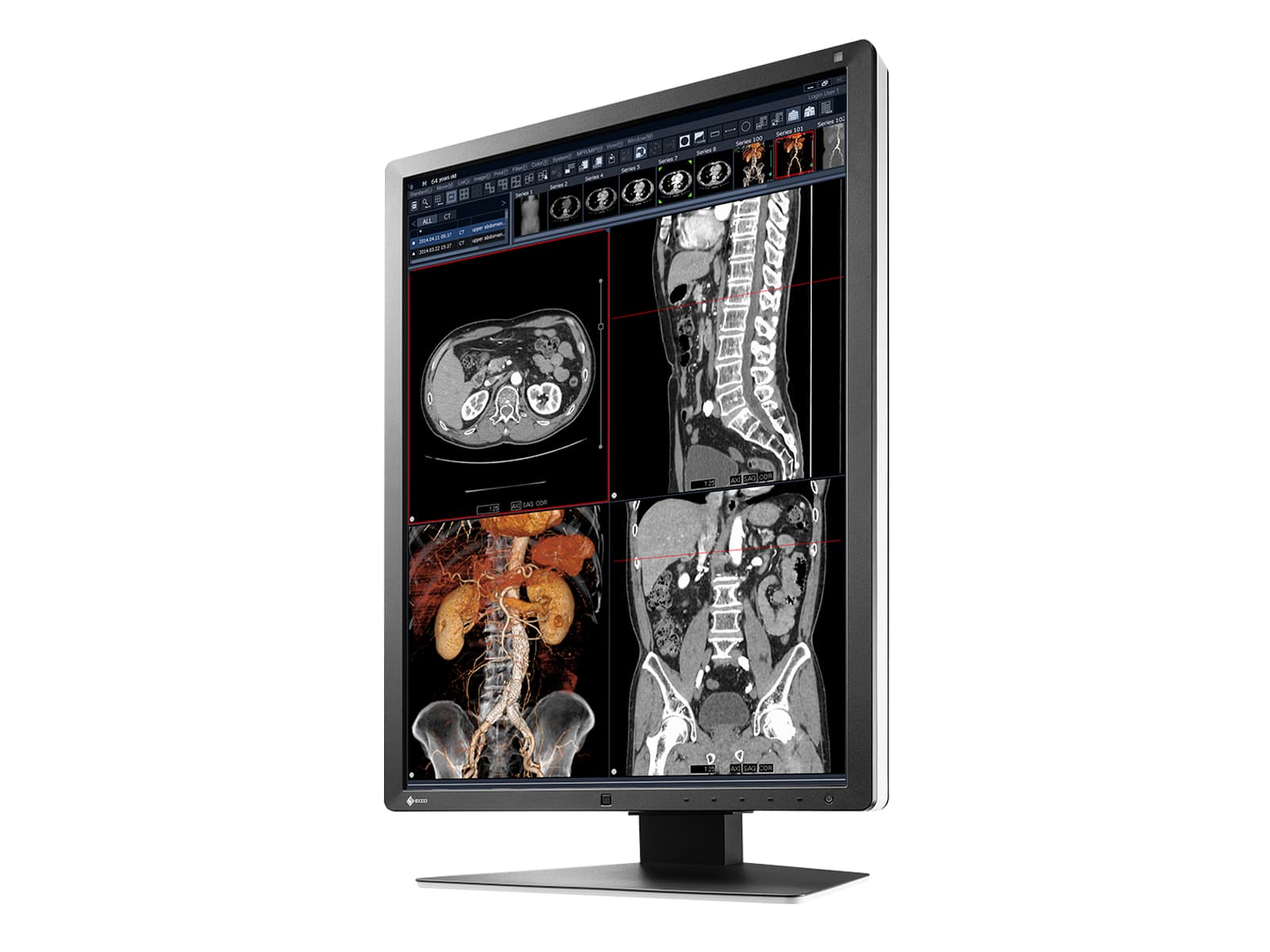 Monitor Médico Eizo RX250-BK 2MP – 21" – Color – Radiología Diagnóstica DICOM (5)