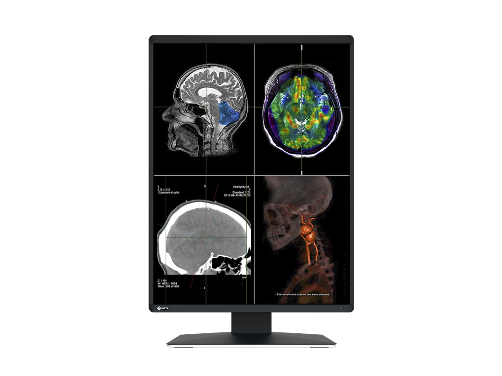 Monitor Médico Eizo RX370 3MP – 21.3" – Color – Radiología Diagnóstica DICOM (3)