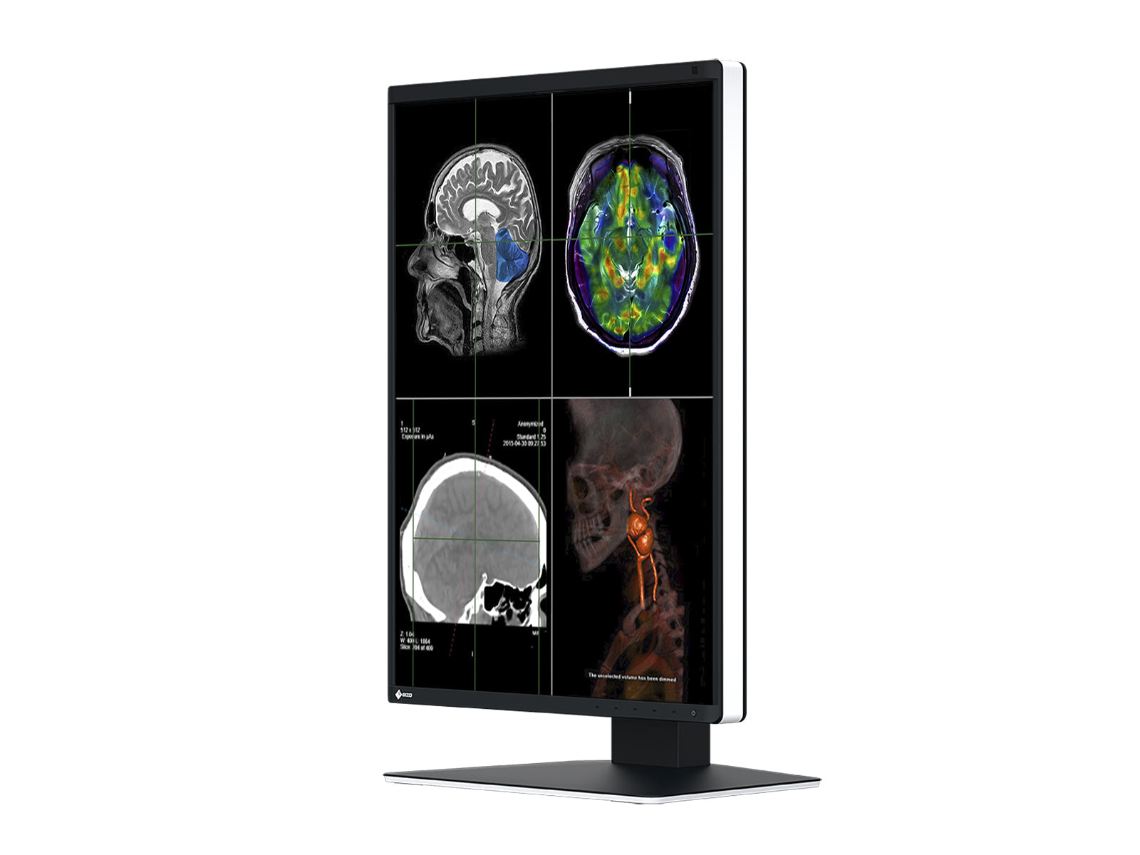 Monitor Médico Eizo RX370 3MP – 21.3" – Color – Radiología Diagnóstica DICOM (4)