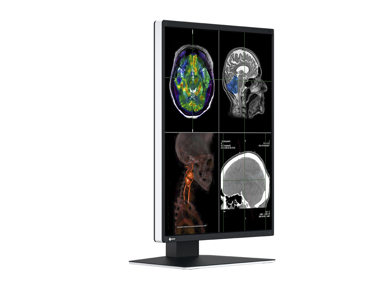Monitor Médico Eizo RX370 3MP – 21.3" – Color – Radiología Diagnóstica DICOM (5)