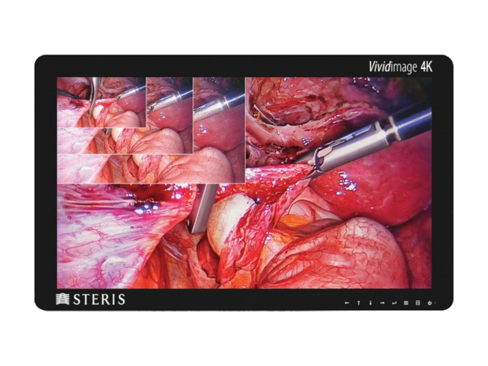 Monitor Médico Steris STERIS-31-4K-R 8MP – 31" – Uso Quirúrgico DICOM (1)