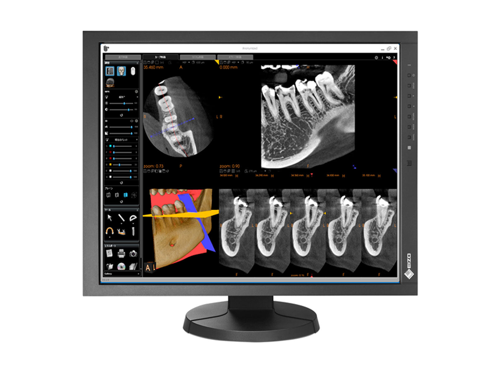 Monitor Médico Eizo MX215-BK 2MP – 21" – Color – Radiología Diagnóstica DICOM (4)