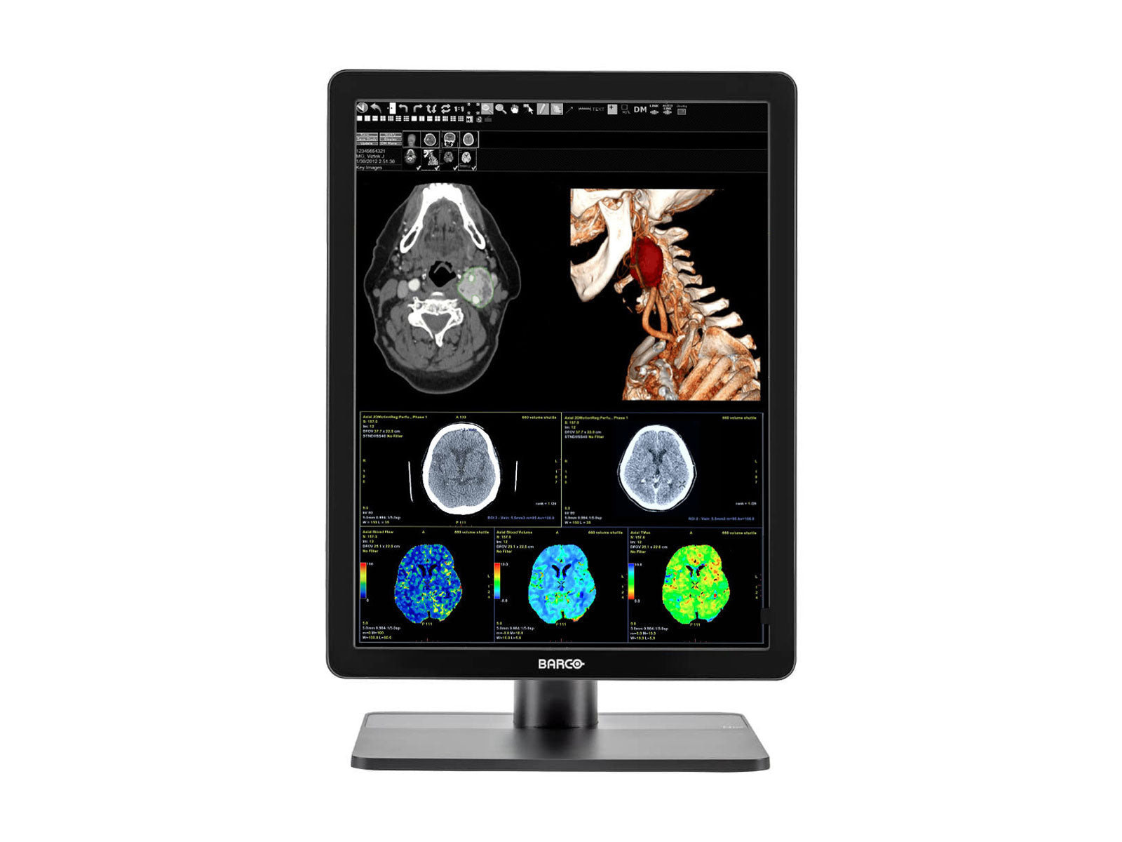 Monitor Médico Barco MDNC-3421 3MP – 21.3" – Color – Radiología Diagnóstica DICOM (3)