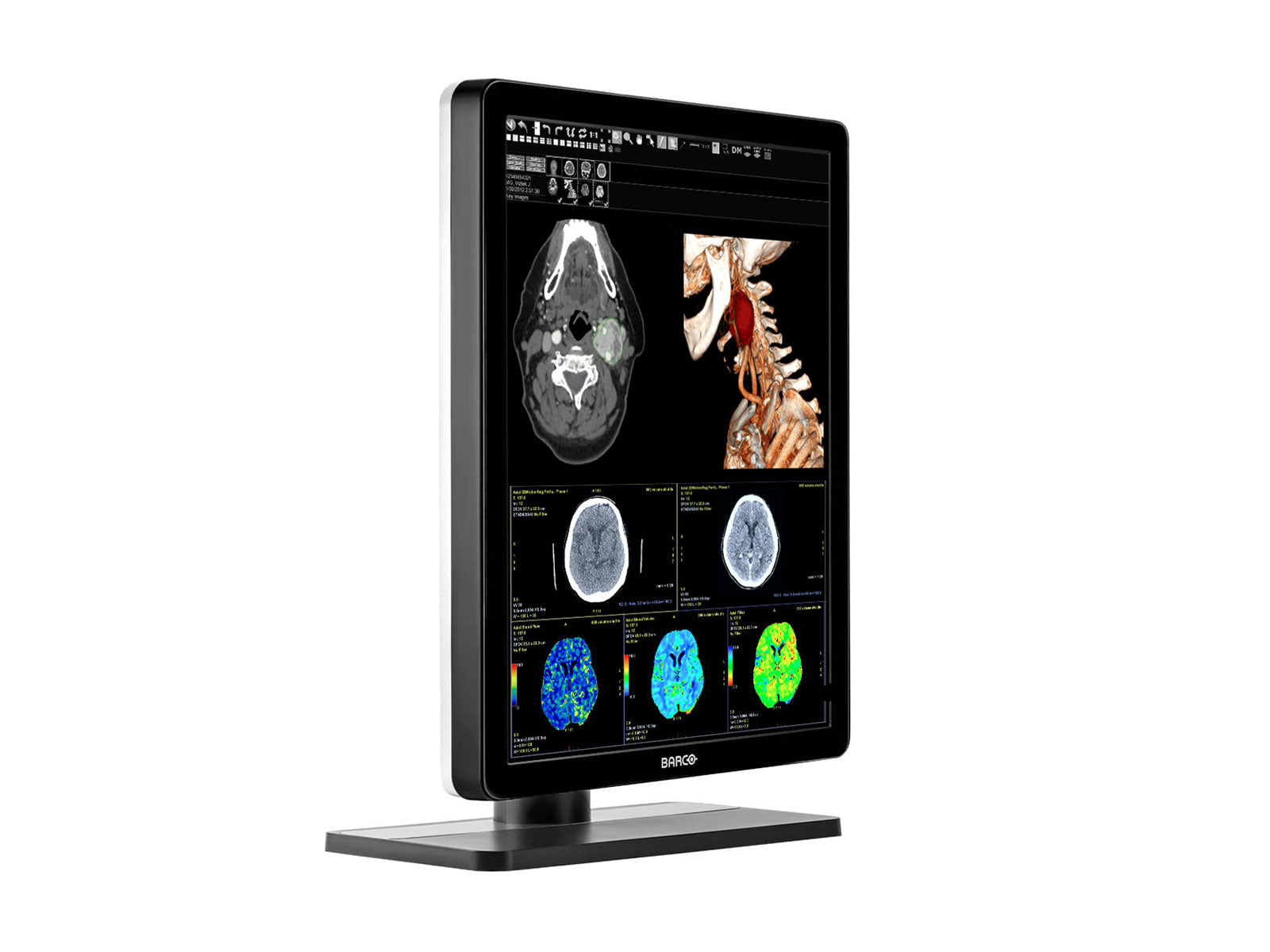 Monitor Médico Barco MDNC-3421 3MP – 21.3" – Color – Radiología Diagnóstica DICOM (4)
