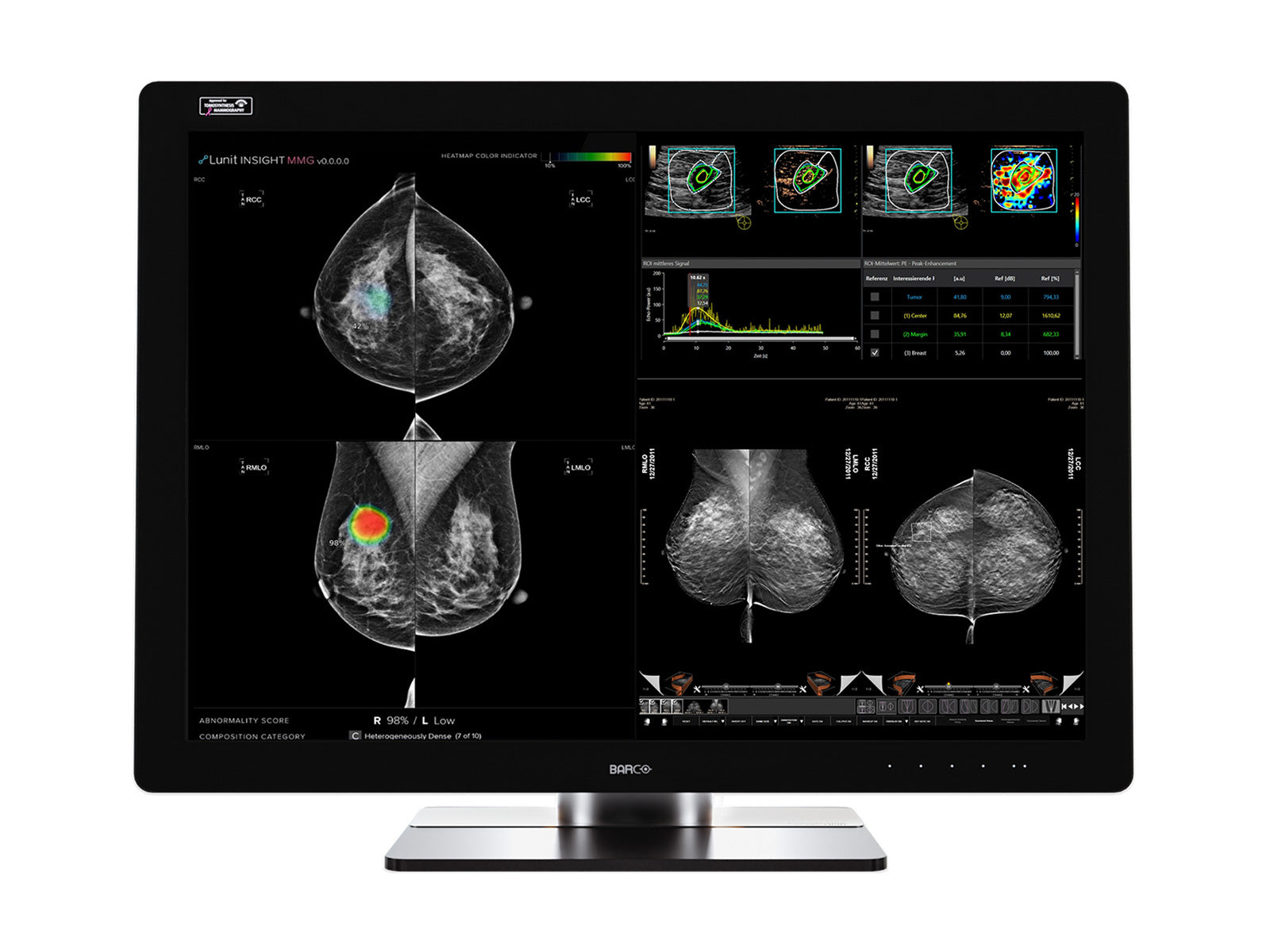 Monitor Médico Barco MDMC-12133 12MP – 33.6" – Color – Radiología Diagnóstica DICOM (1)