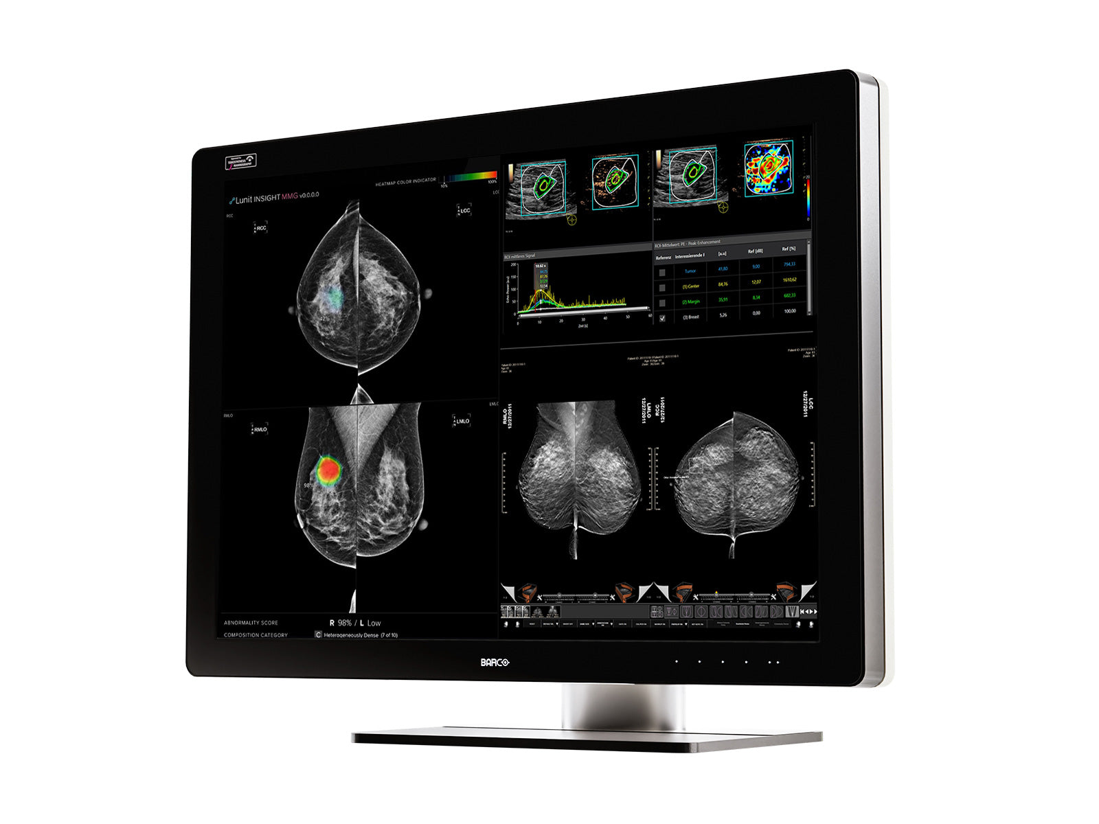 Monitor Médico Barco MDMC-12133 12MP – 33.6" – Color – Radiología Diagnóstica DICOM (2)