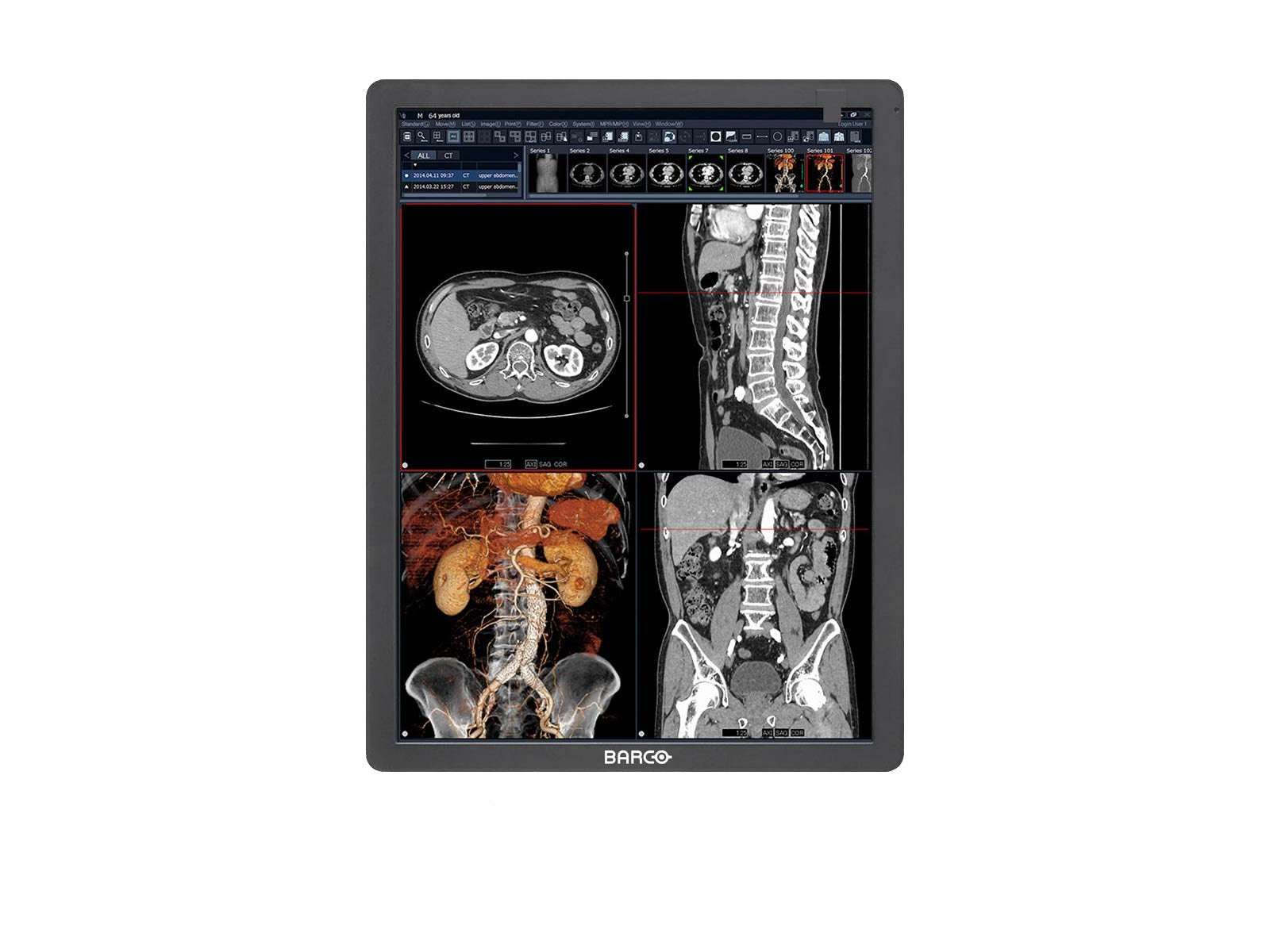 Monitor Médico Barco MDRC-2321 2MP – 21" – Color – Revisión Clínica (1)