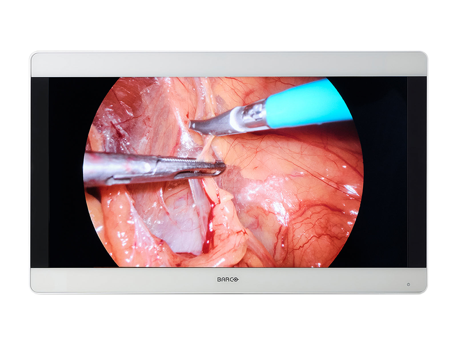 Monitor Médico Barco MDSC-8231 8MP – 31" – Uso Quirúrgico DICOM (1)