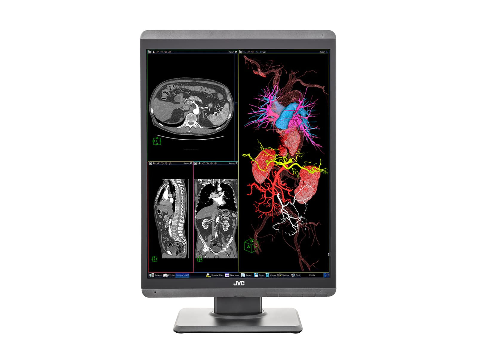 Monitor Médico JVC CL-S300 3MP – 21.3" – Color – Radiología Diagnóstica DICOM (4)