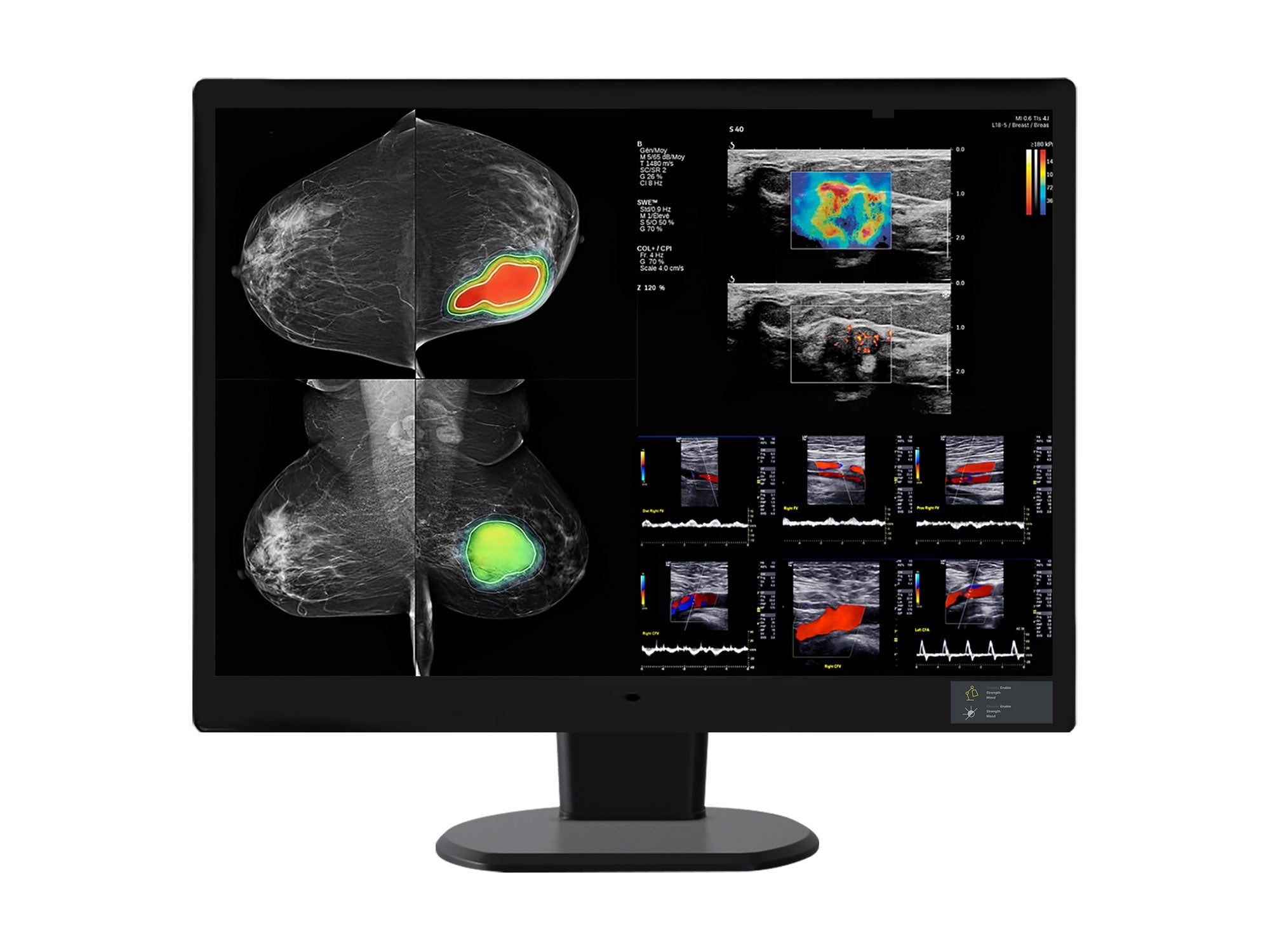 Monitor Médico WIDE CW120N 12MP – 31" – Color – Radiología Diagnóstica DICOM (1)