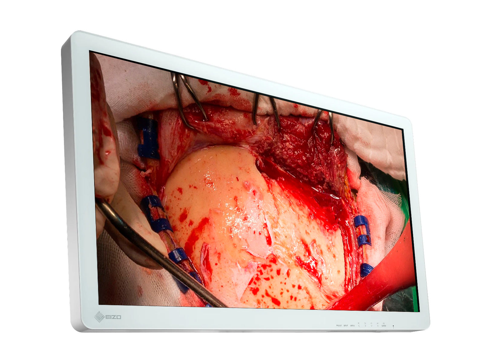 Monitor Médico Eizo EX3220 31.5" – Uso Quirúrgico DICOM (2)