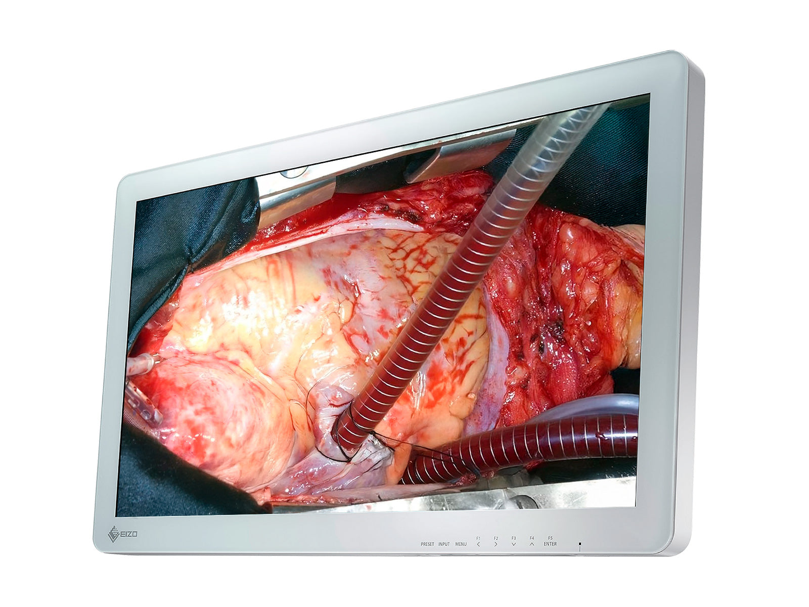 Monitor Médico Eizo EX2620 26" – Uso Quirúrgico DICOM (2)